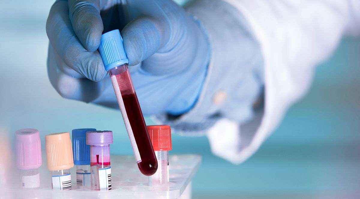 Blueberry Diagnostics lanza el primer test basado en un análisis de sangre para el diagnóstico de COVID-19