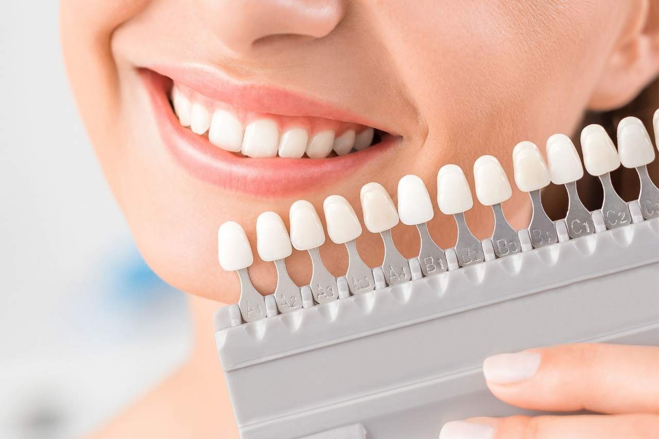 Clínica dental Helident en Sevilla: búsquedas acerca de los implantes dentales en Sevilla