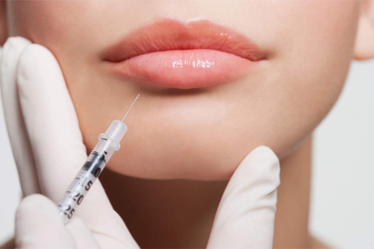 Tratamiento de aumento de labios en la Clínica Dr. Zito