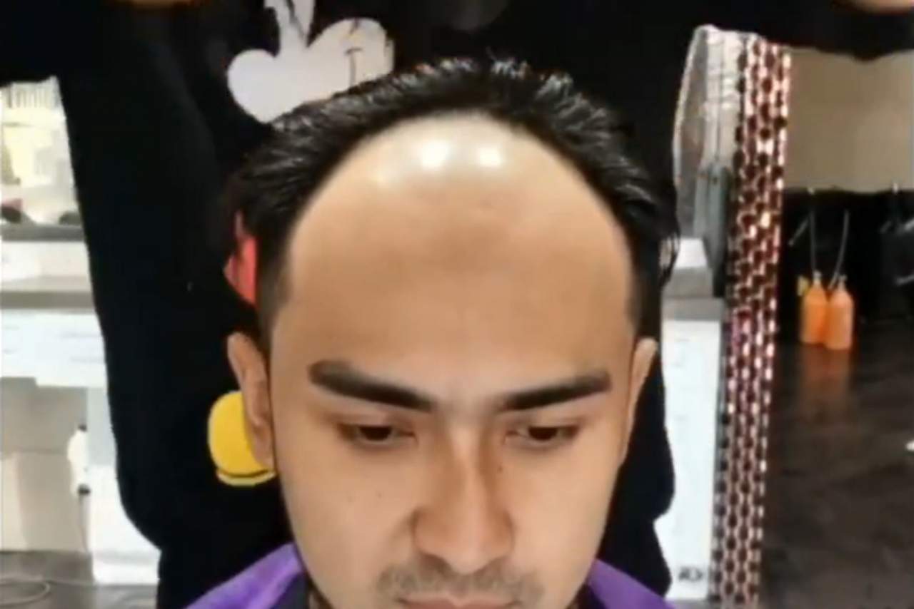 My Special Hair: prótesis capilares masculina para luchar contra la caída de pelo