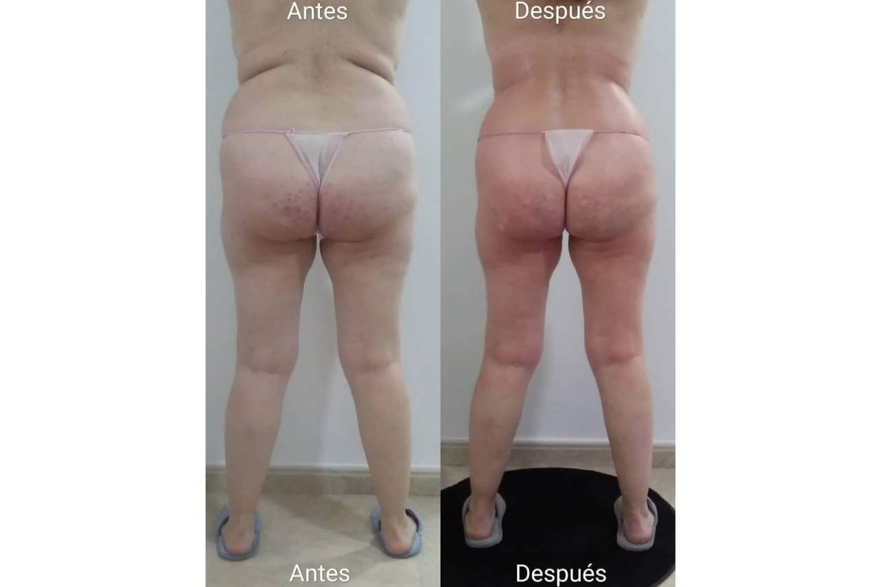 Vanesa Vendrell Estética es el centro de estética tendencia en el corazón de Valencia para tratamientos reductores y anticelulíticos
