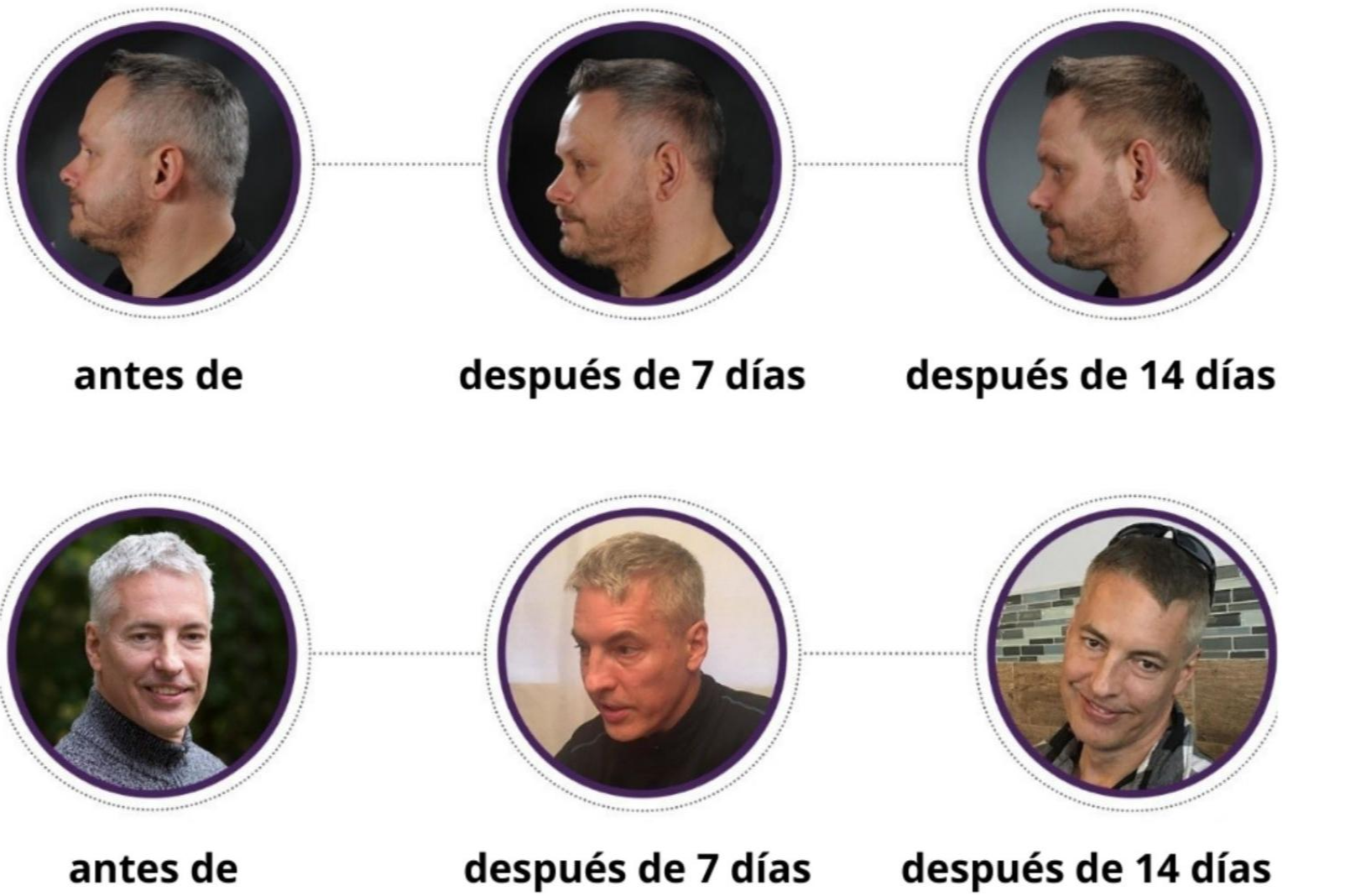 ¿Cómo tapar las canas sin tinte?  La loción GR-7 Professional ha revolucionado en mercado