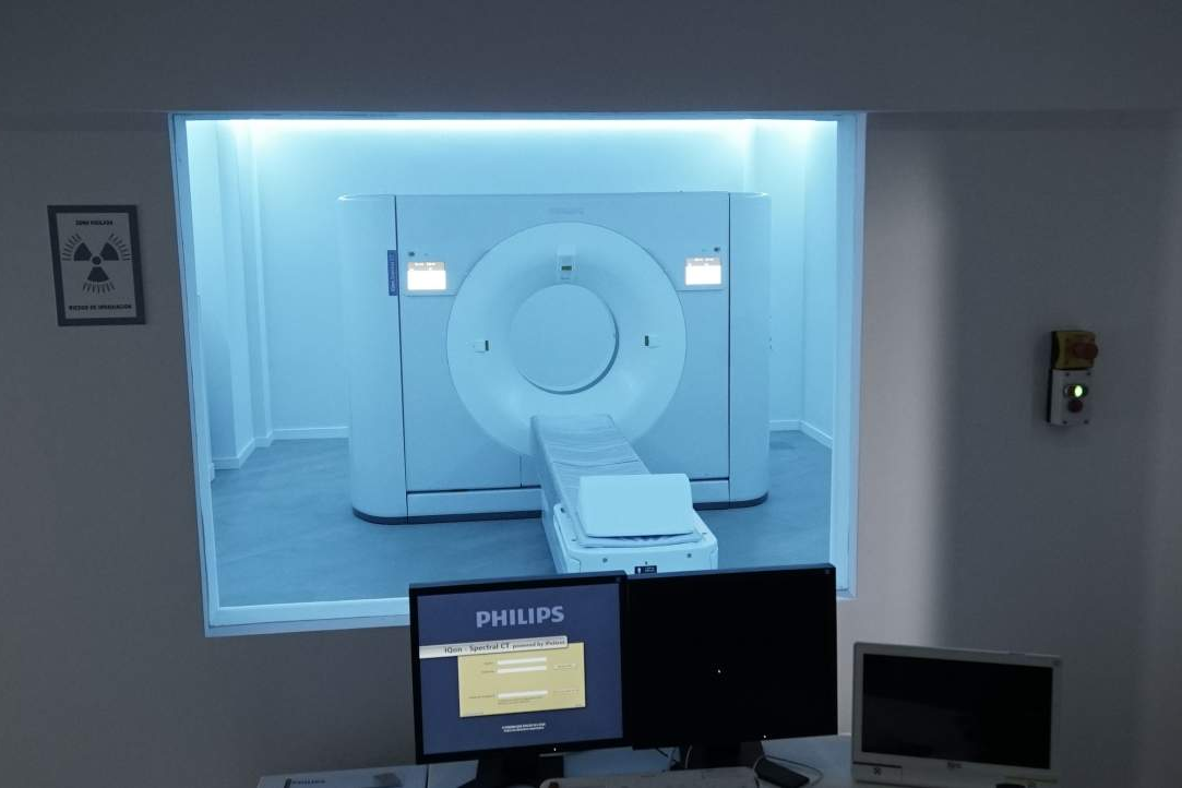 El escáner médico de detección espectral permite prevenir patologías cardiovasculares