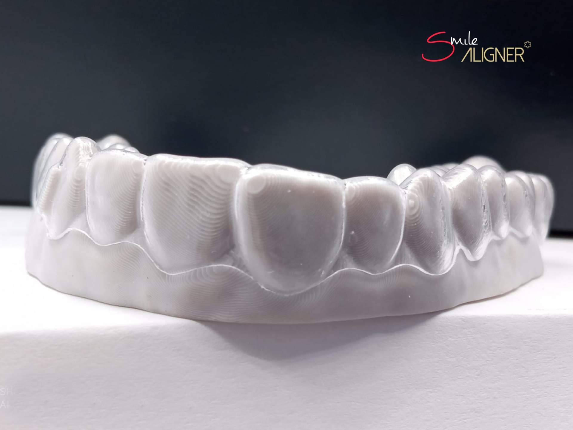 Smile Aligner, la novedosa ortodoncia invisible exclusiva de Clínicas Hernadent
