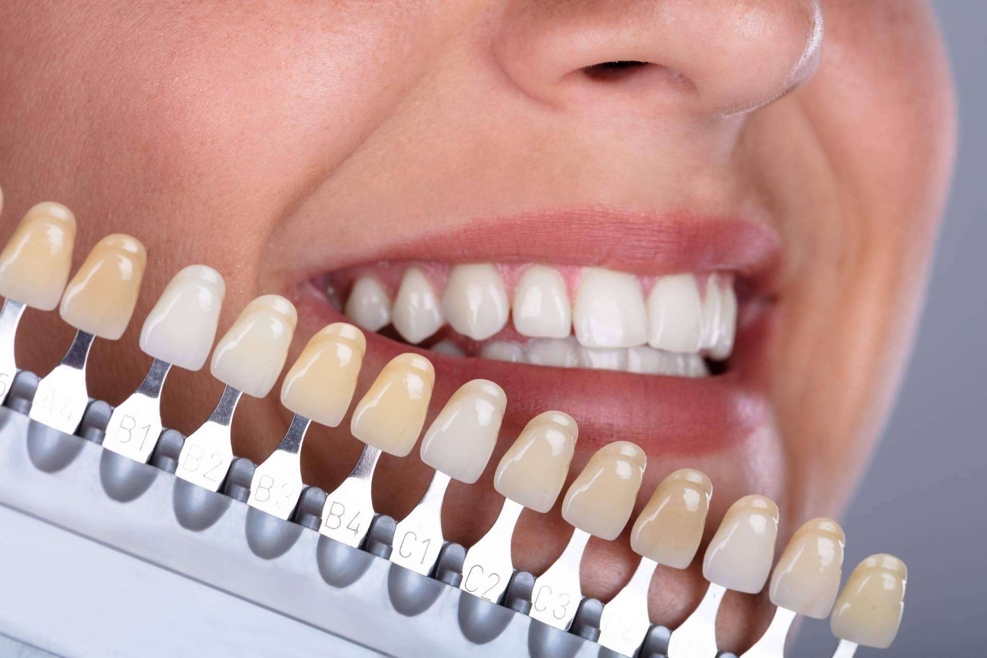 Ortodoncia: mejorar la sonrisa con Clínica Viasalud
