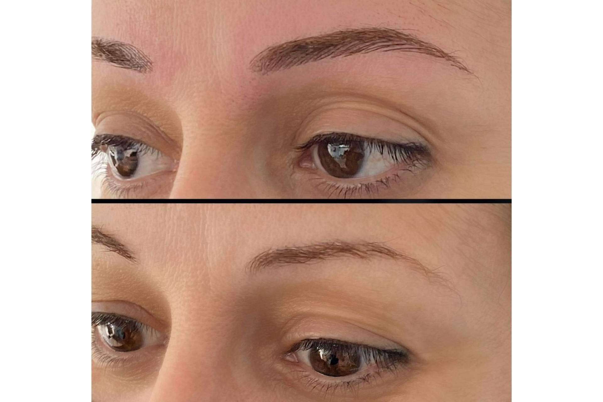 El microblading de la Dra. Julieta Gil permite lucir un rostro siempre perfecto