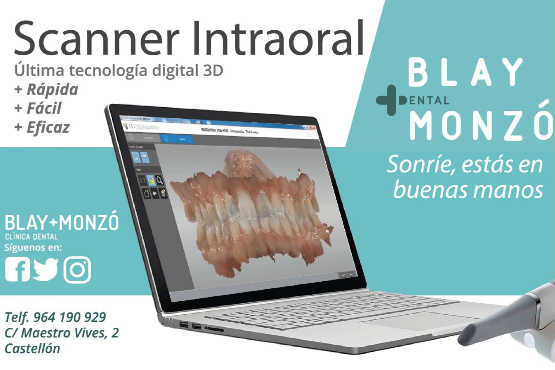 Clínica Blay Monzó: odontología digital con las técnicas más avanzadas en implantología