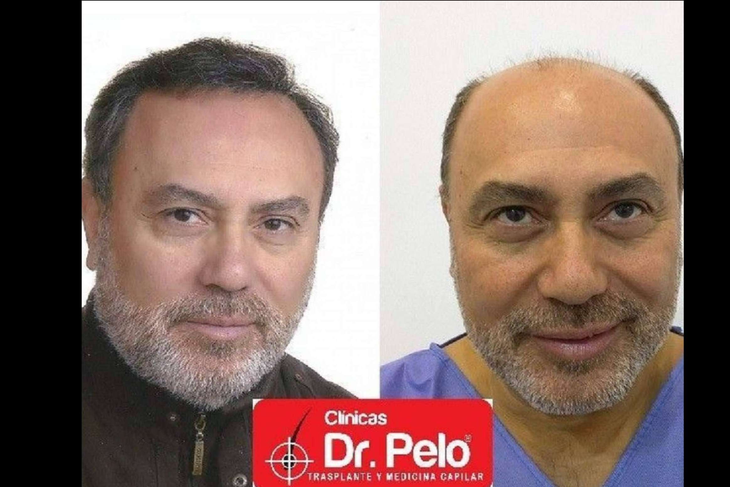 Tratamientos capilares de todo tipo en la red de Clínicas Dr. Pelo