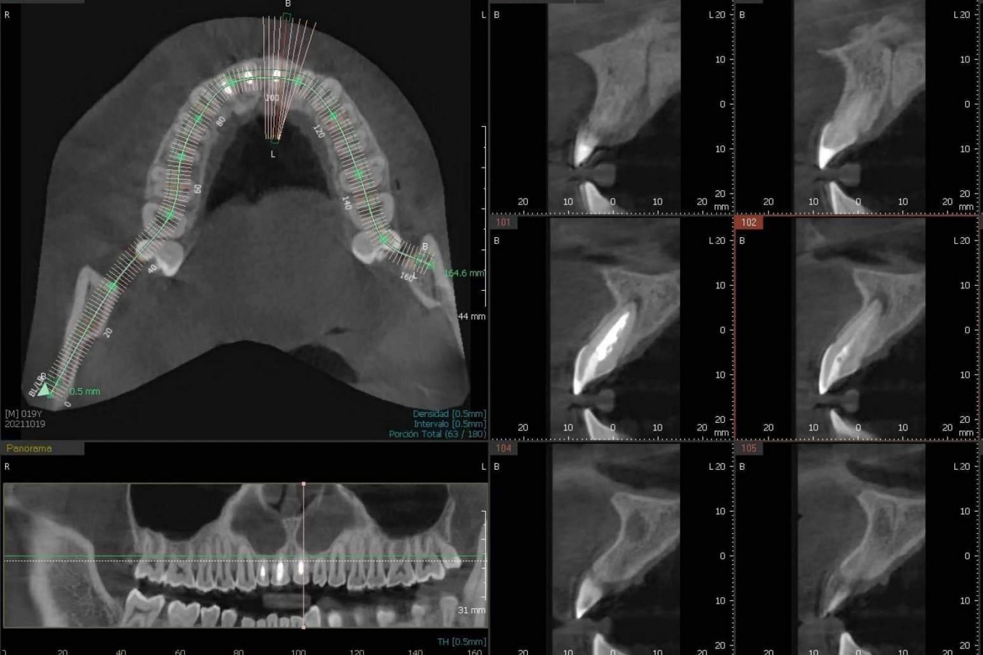 El innovador CBCT dental 3D que realiza la Clínica Blay+Monzó
