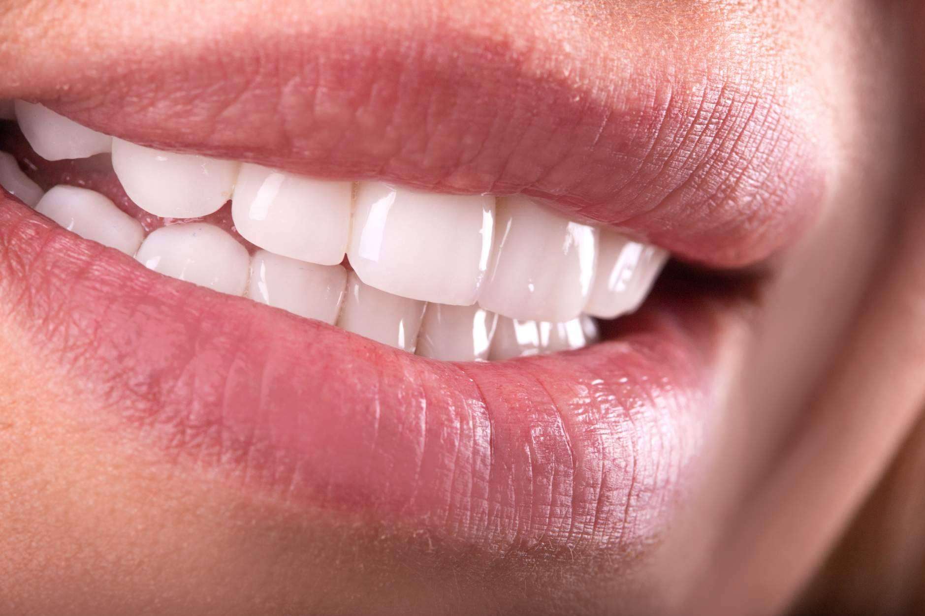 Clínica Sonrisas de Corrales Dental garantiza calidad en implantes dentales y profesionalidad