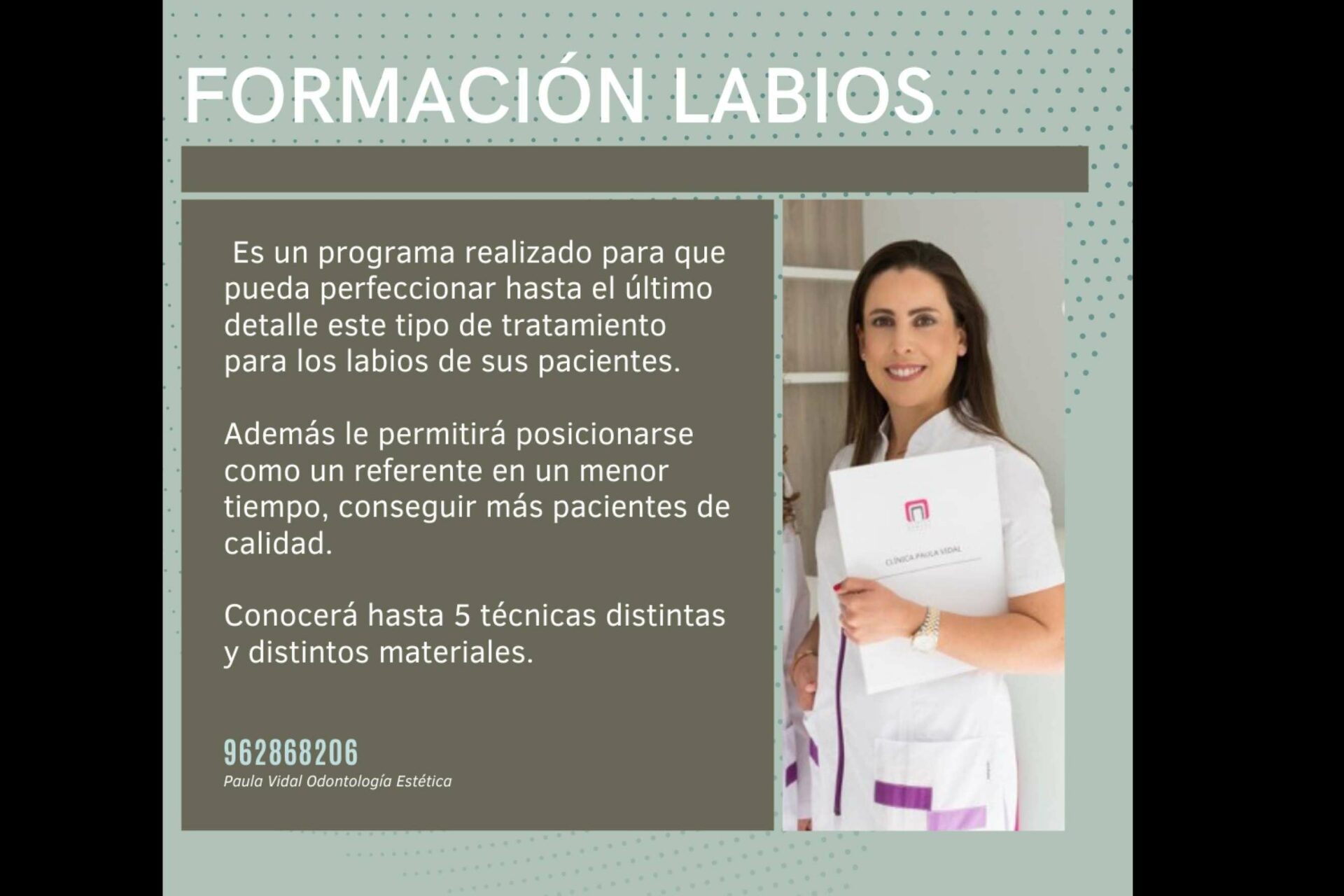 Clínica Paula Vidal, curso para odontólogos de relleno de ácido hialurónico