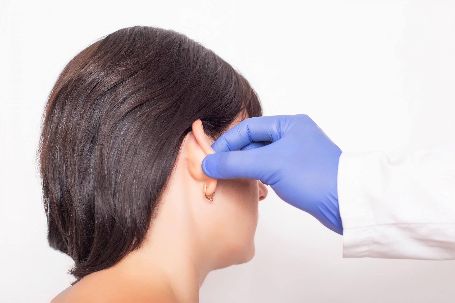 Otoplastia, una cirugía mínimamente invasiva realizada por el doctor especialista Luis Miguel Beltrán
