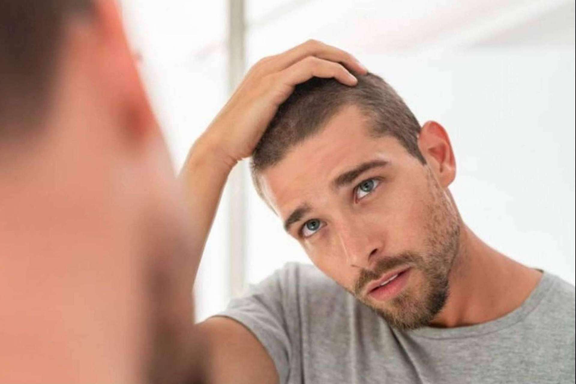 Los tratamientos efectivos de Clínica Tarrazo para decir adiós a la caída del cabello