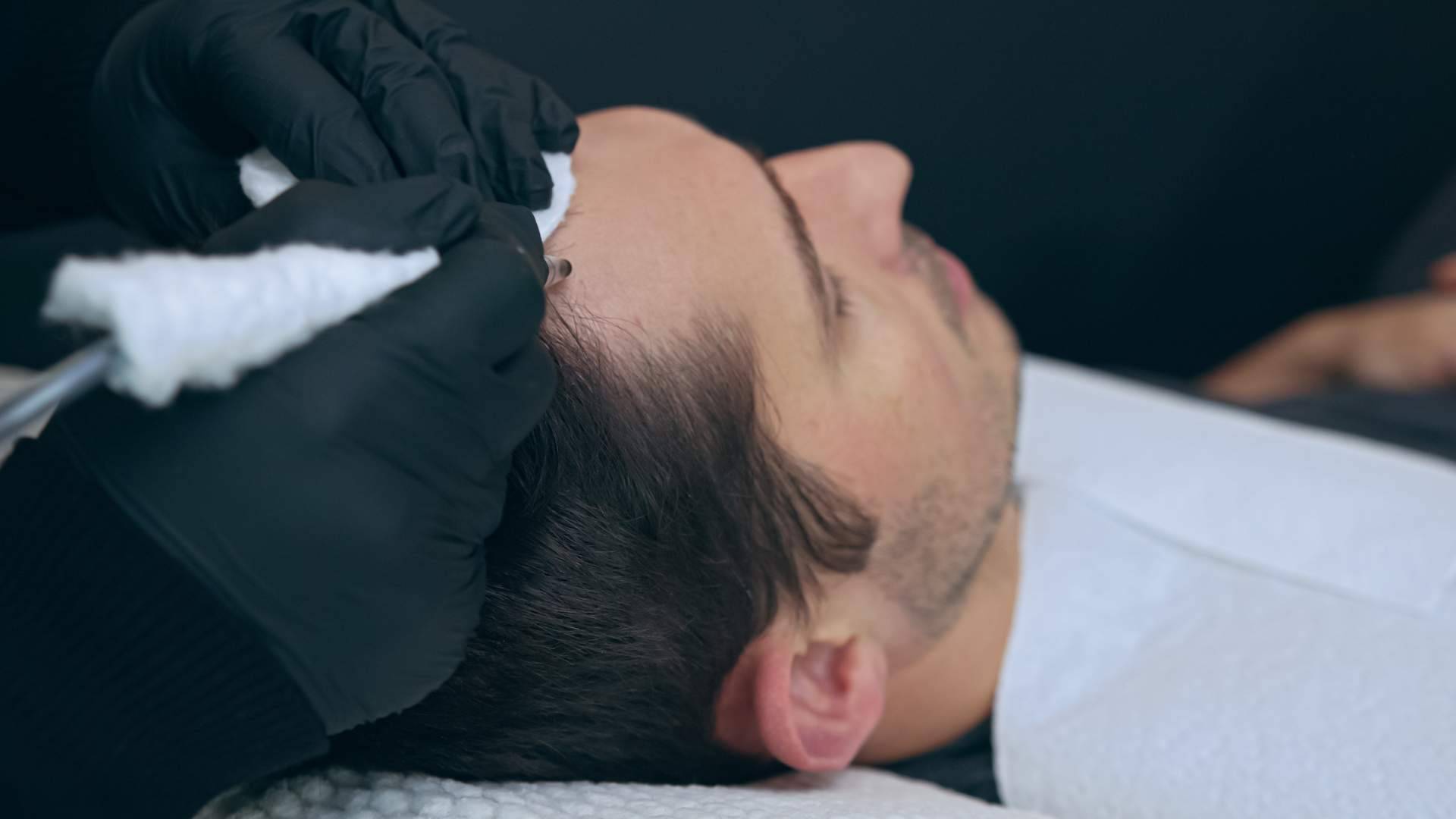 Los tratamientos de micropigmentación con efecto de redensificación disponibles en las Clínicas Dr. Pelo
