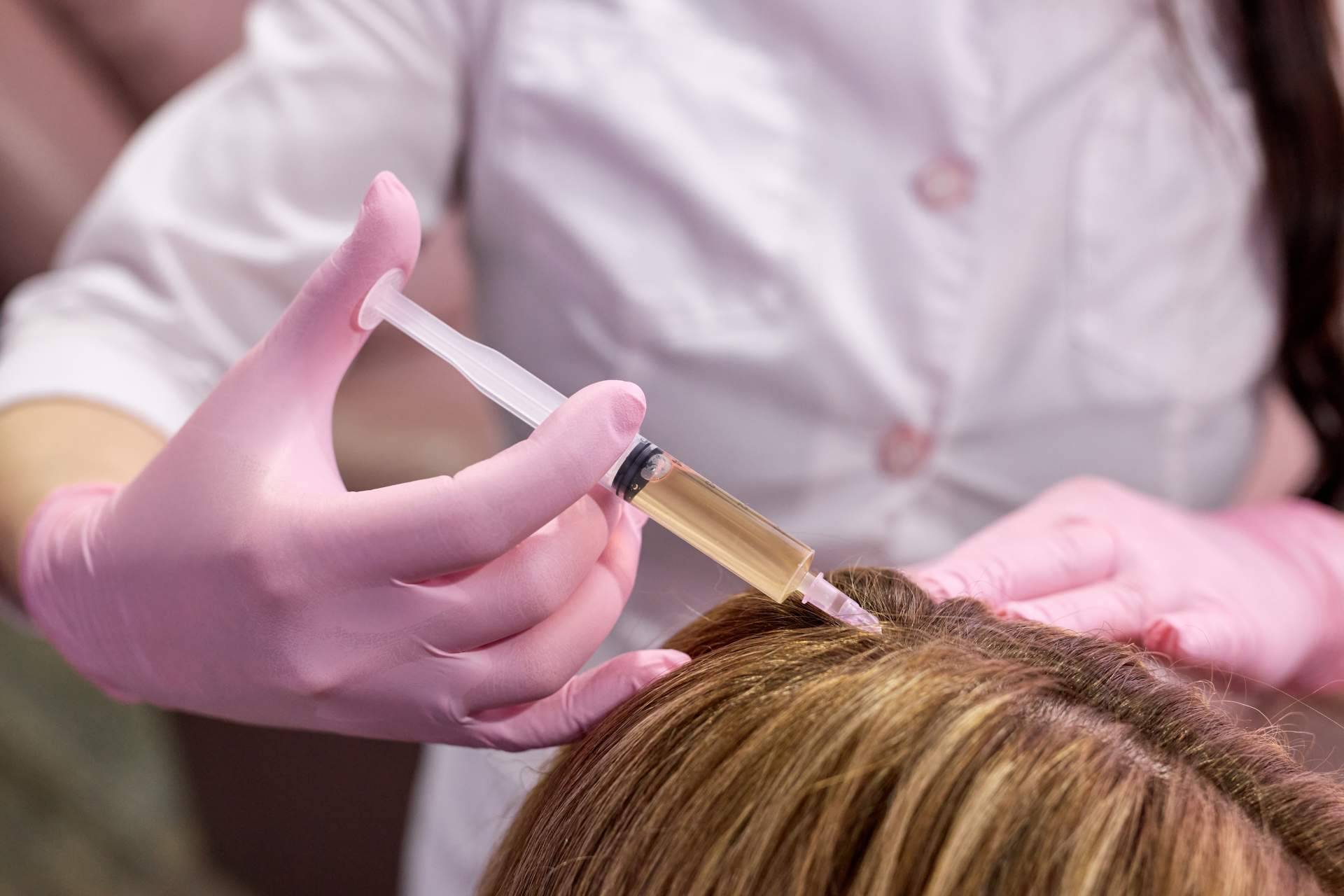 Los tratamientos de mesoterapia capilar en Benidorm y Elche que realiza Élite Capilar