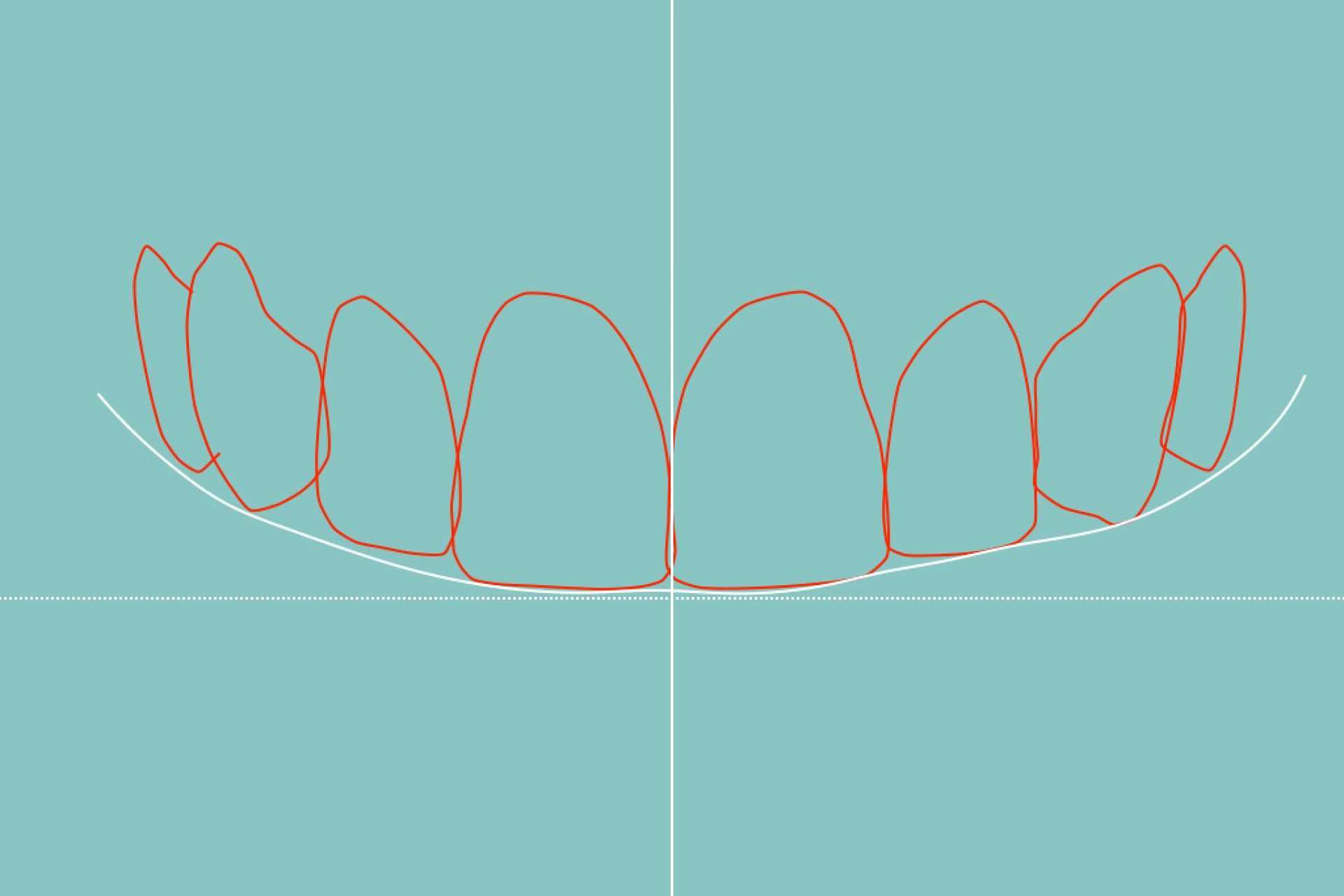 Tecnología de vanguardia para el diseño de sonrisa de la mano de Clínica Dental Blay + Monzó