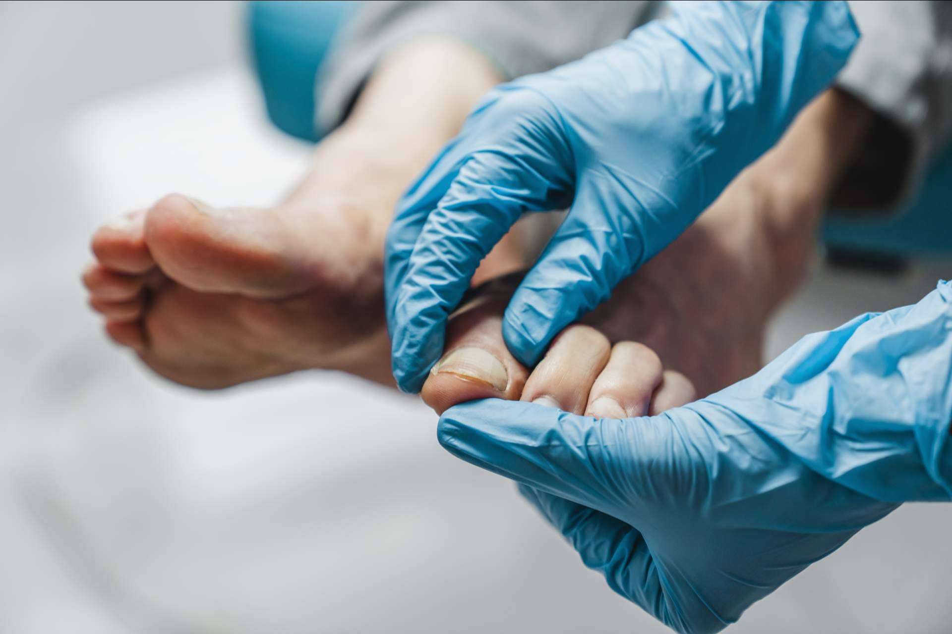 Tratar las afecciones de los pies a tiempo mediante la quiropodia de la mano de los expertos de podología de Clínica Viasalud