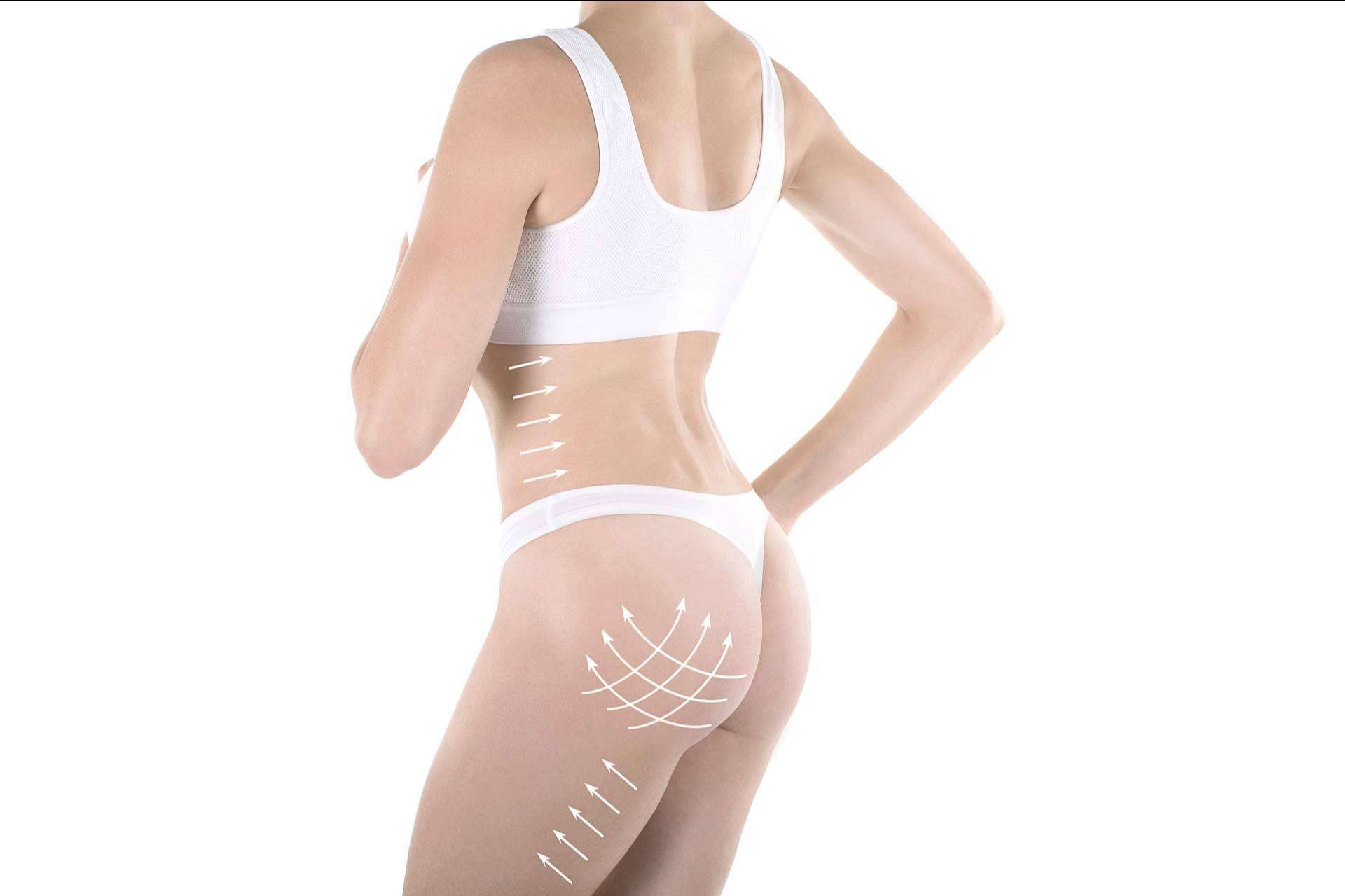 El aumento de glúteos en Clínica Tarrazo, Brazilian Butt Lift