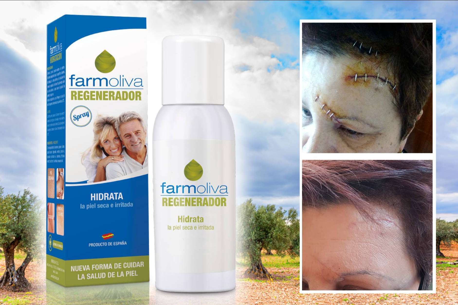 Farmoliva Regenerador, el spray de Farmoliva que ayuda a la piel a regenerarse de manera natural para mantenerla sana