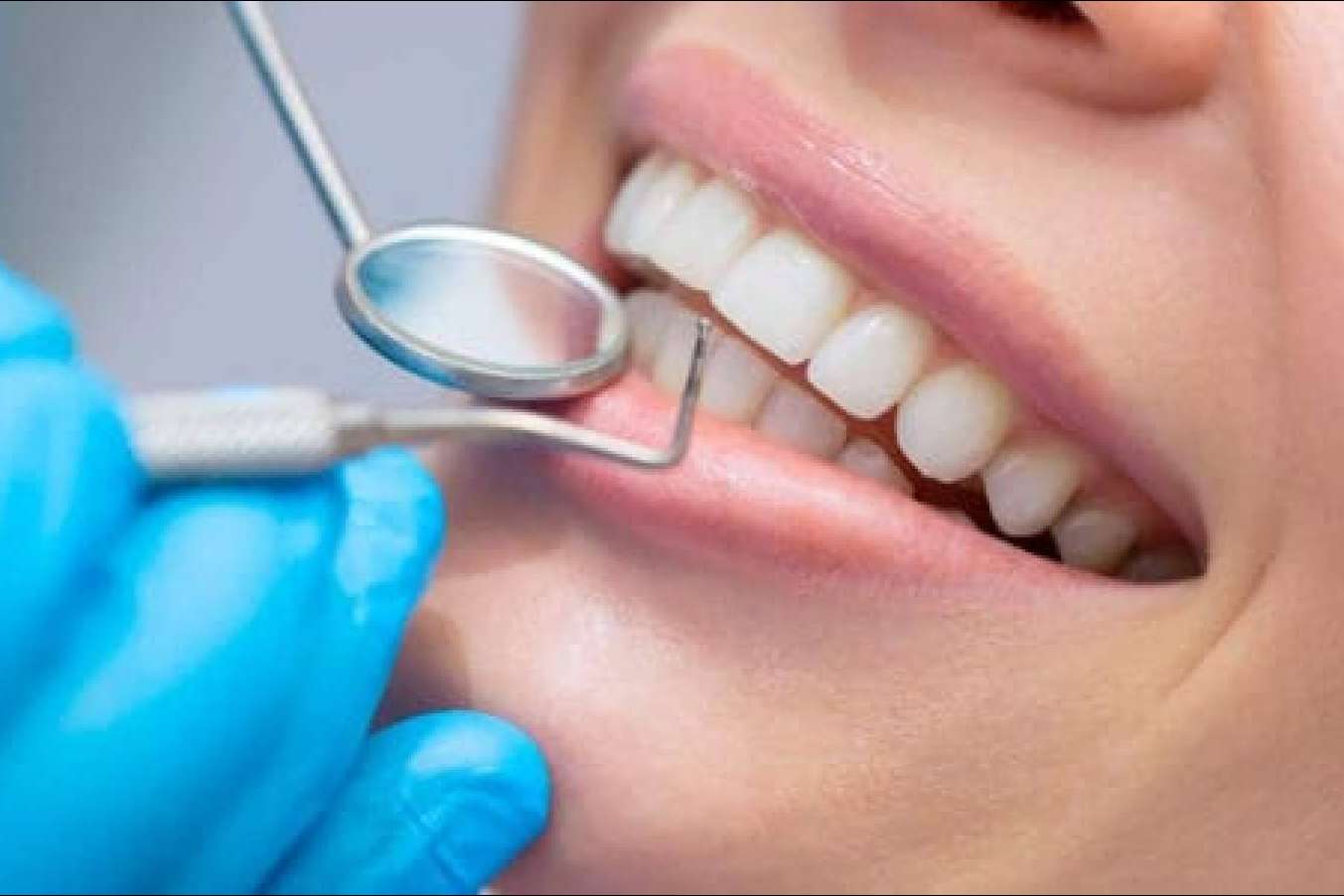 Una buena salud bucal a un precio asequible con el seguro Adeslas Dental