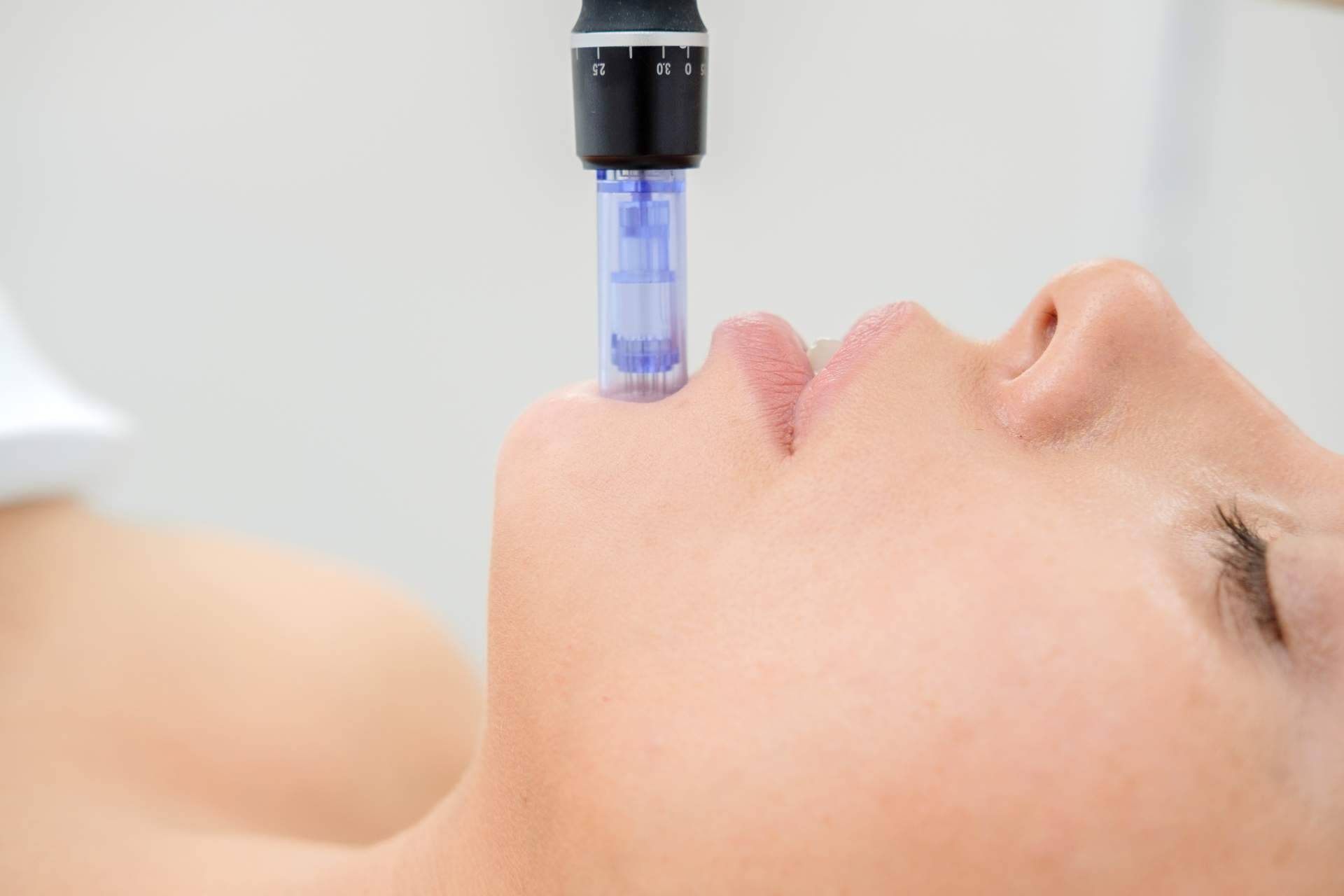 Los tratamientos faciales de Policlinica ICD son una alternativa para preparar el rostro esta primavera