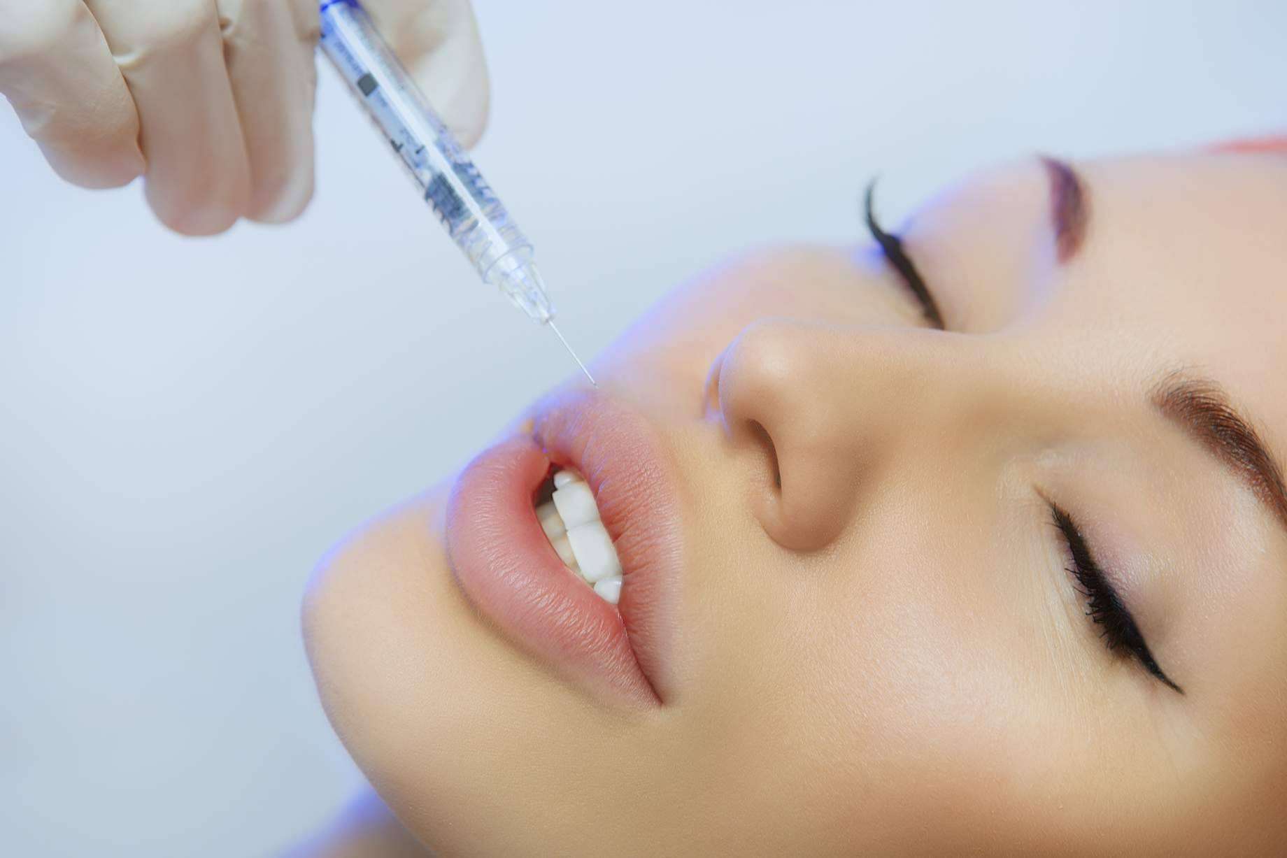 En Barcelona, el Dr. Carlos Zito realiza el aumento de labios