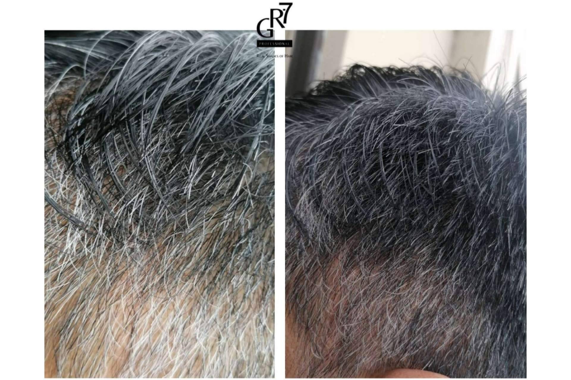¿Por qué aparecen las canas y cómo revertir su aparición?, por GR-7 Professional