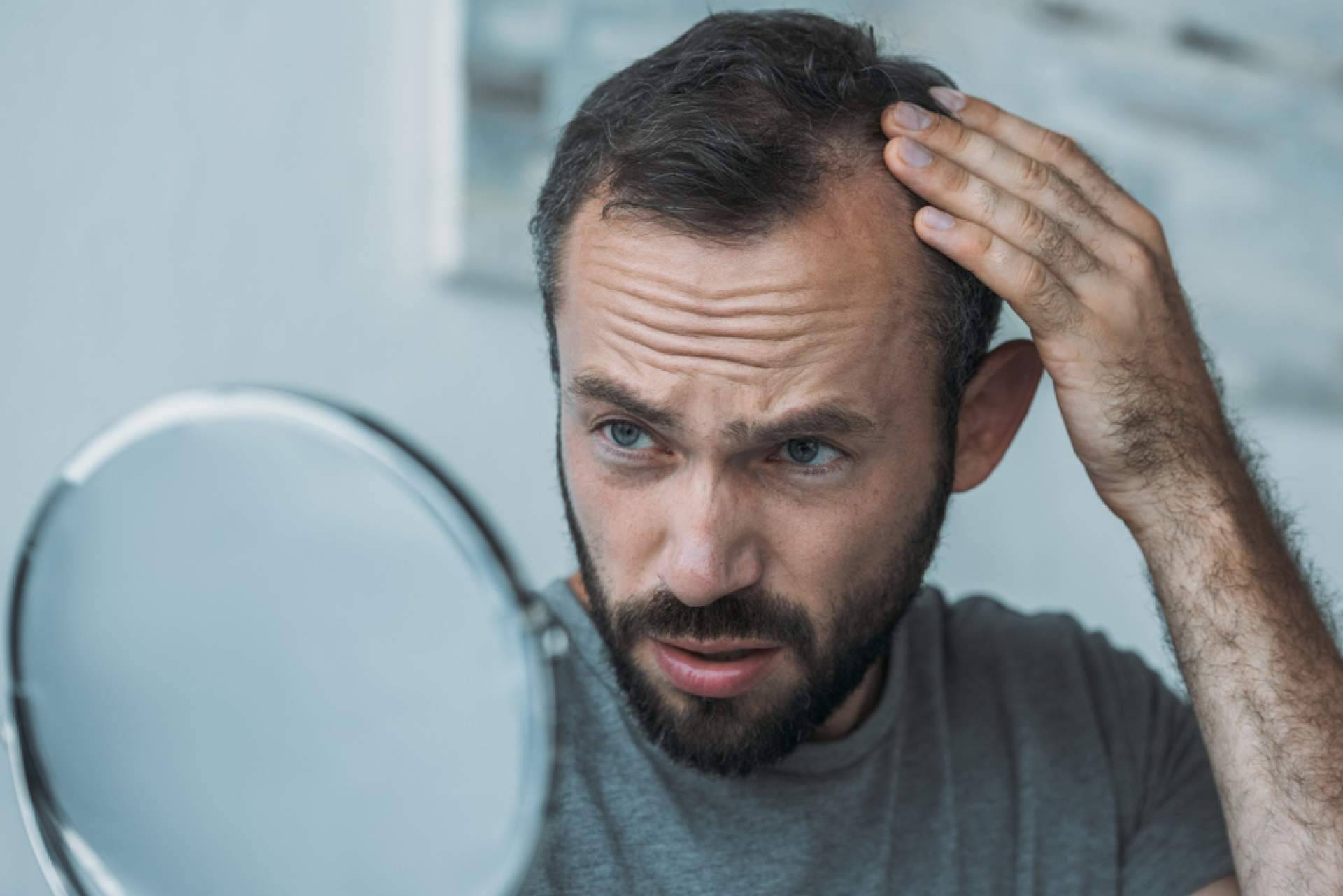 Saw Palmetto ofrece Xpecia Tablet, una alternativa para combatir la alopecia
