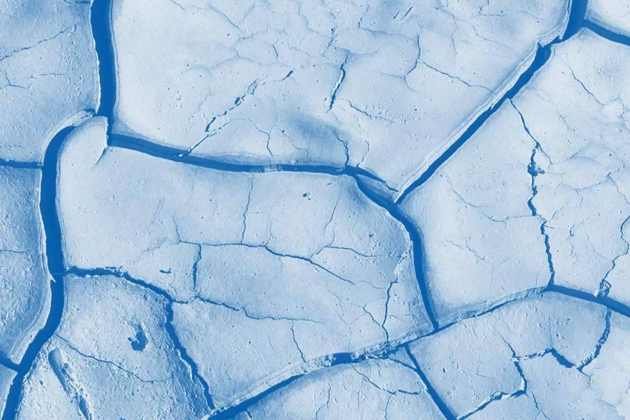 ¿Cuáles son los síntomas de falta de salivación?, por Dicadia