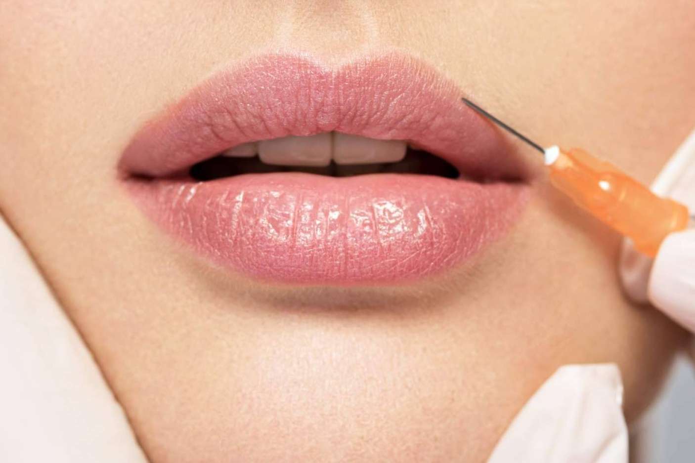 Frenar el envejecimiento de la piel, con el método de la mesoterapia facial