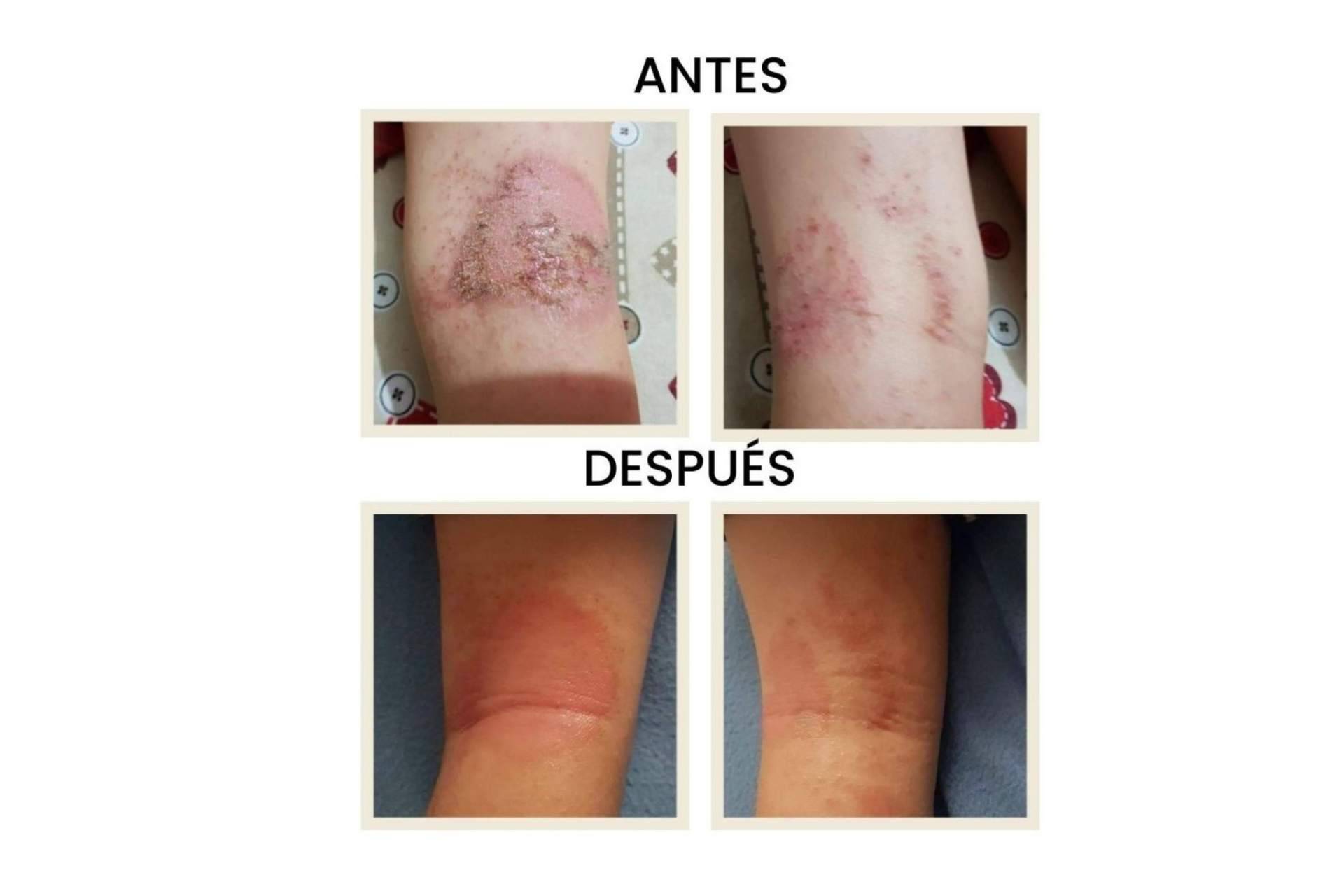 El plan de expansión en el canal físico, farmacias y parafarmacias de Green Cornerss