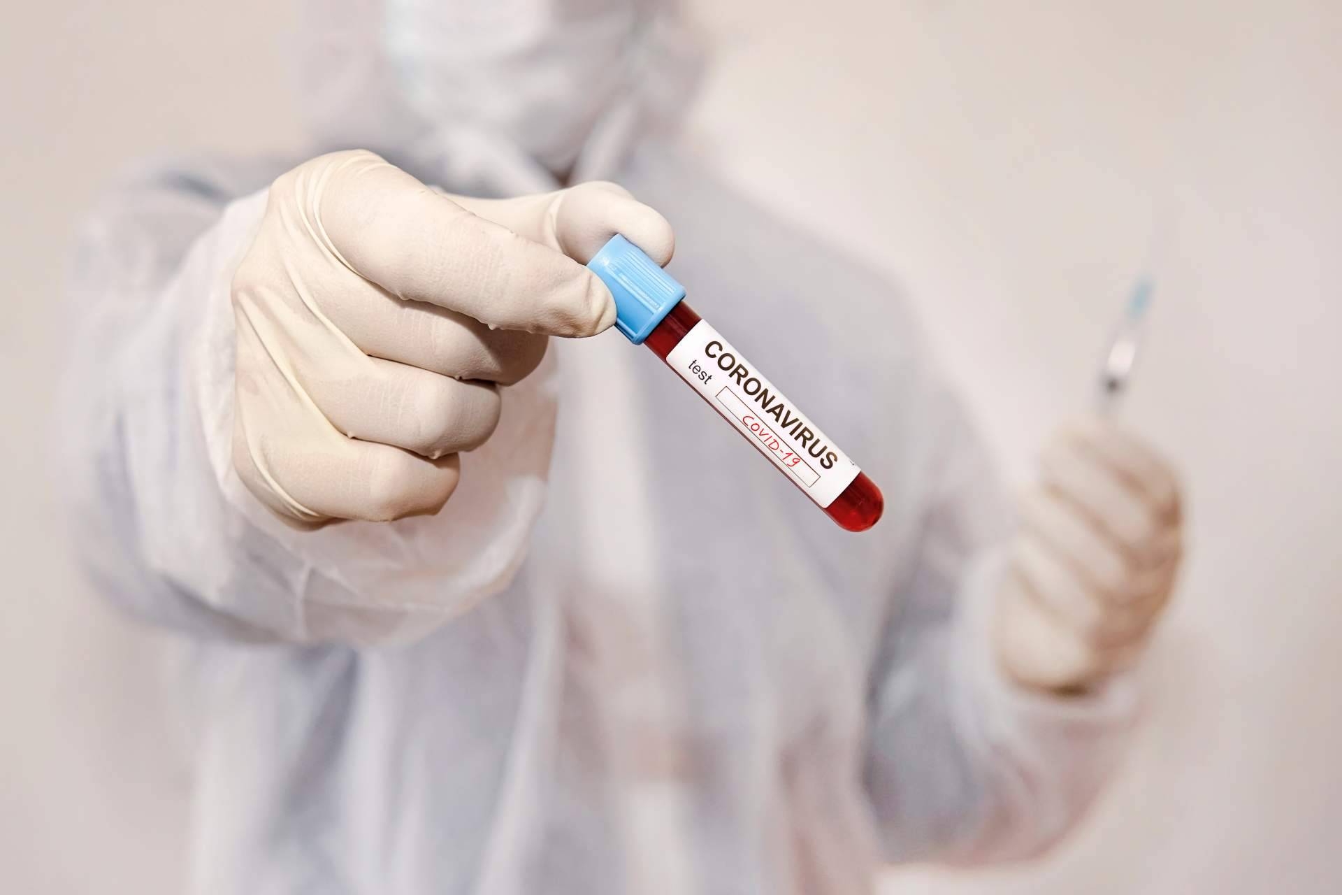 Centro Médico Bravo realiza diferentes pruebas de test covid en Madrid para viajar en verano