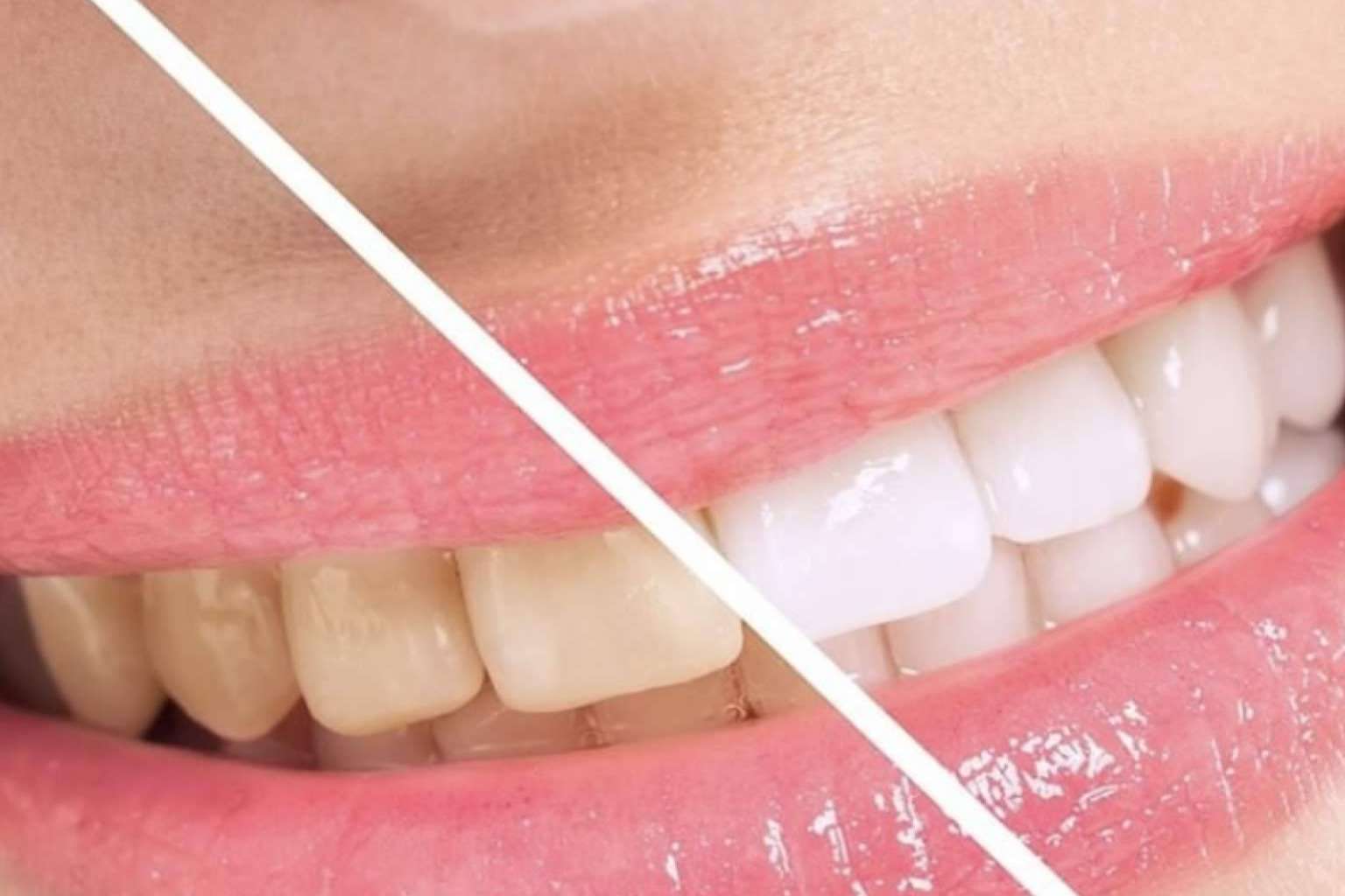 DeltaDent recalca la importancia de realizarse tratamientos dentales de la mano de expertos