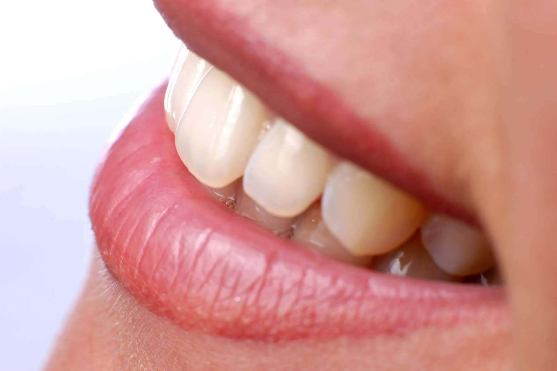 Conseguir una sonrisa sana y bonita con los implantes dentales de Calident en Sitges Barcelona