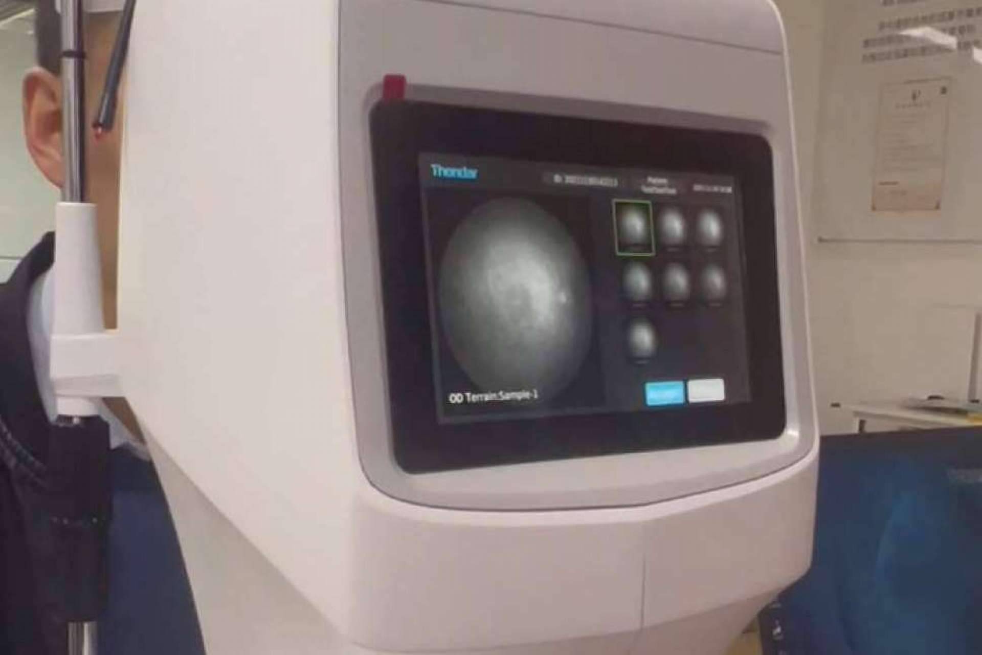 Mayor control de la miopía con el sistema de diagnóstico multiespectral