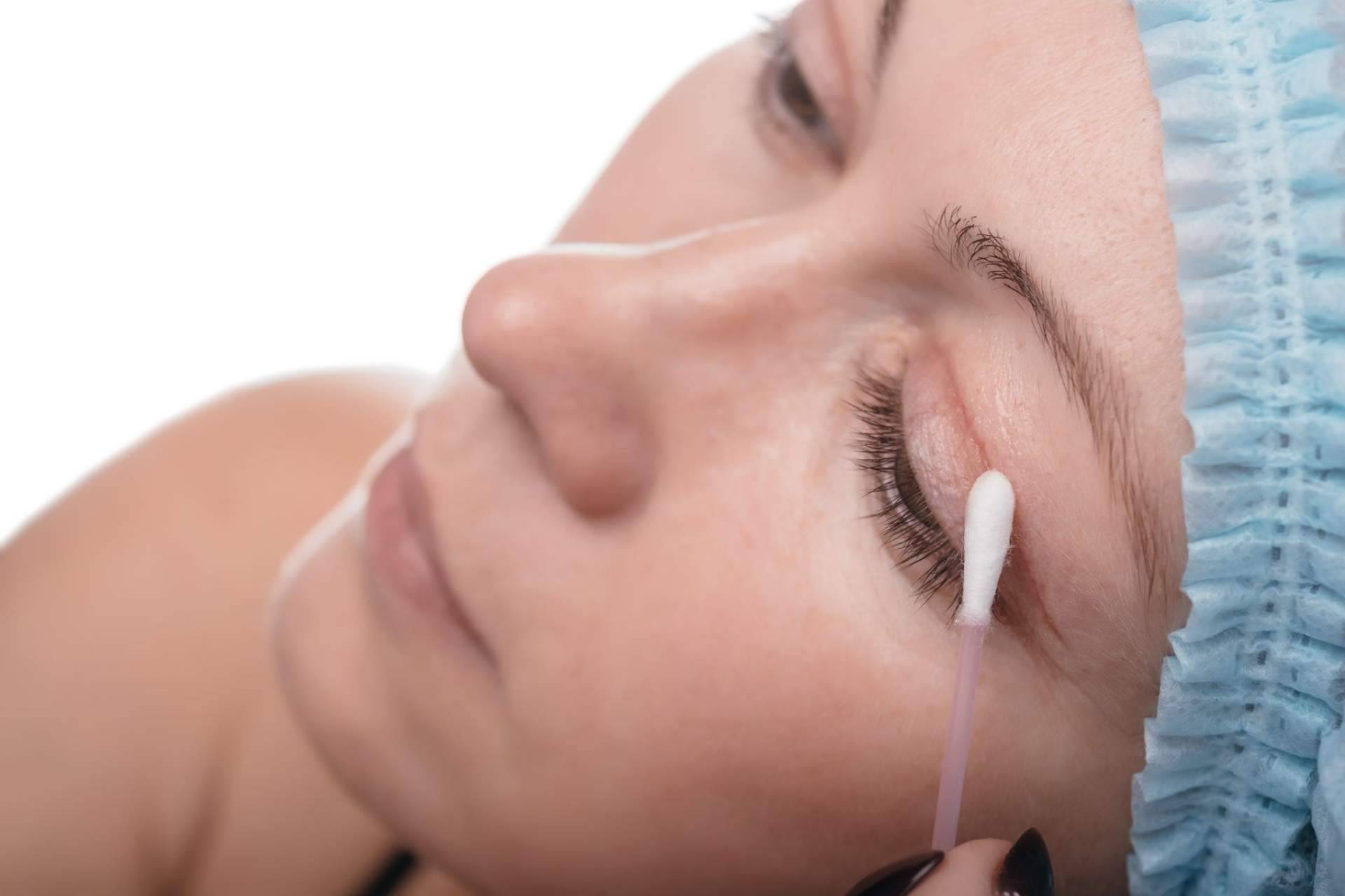 Uno de los referentes de blefaroplastia mínimamente invasiva de Barcelona es la Clinica de Medicina Estética Elegansse