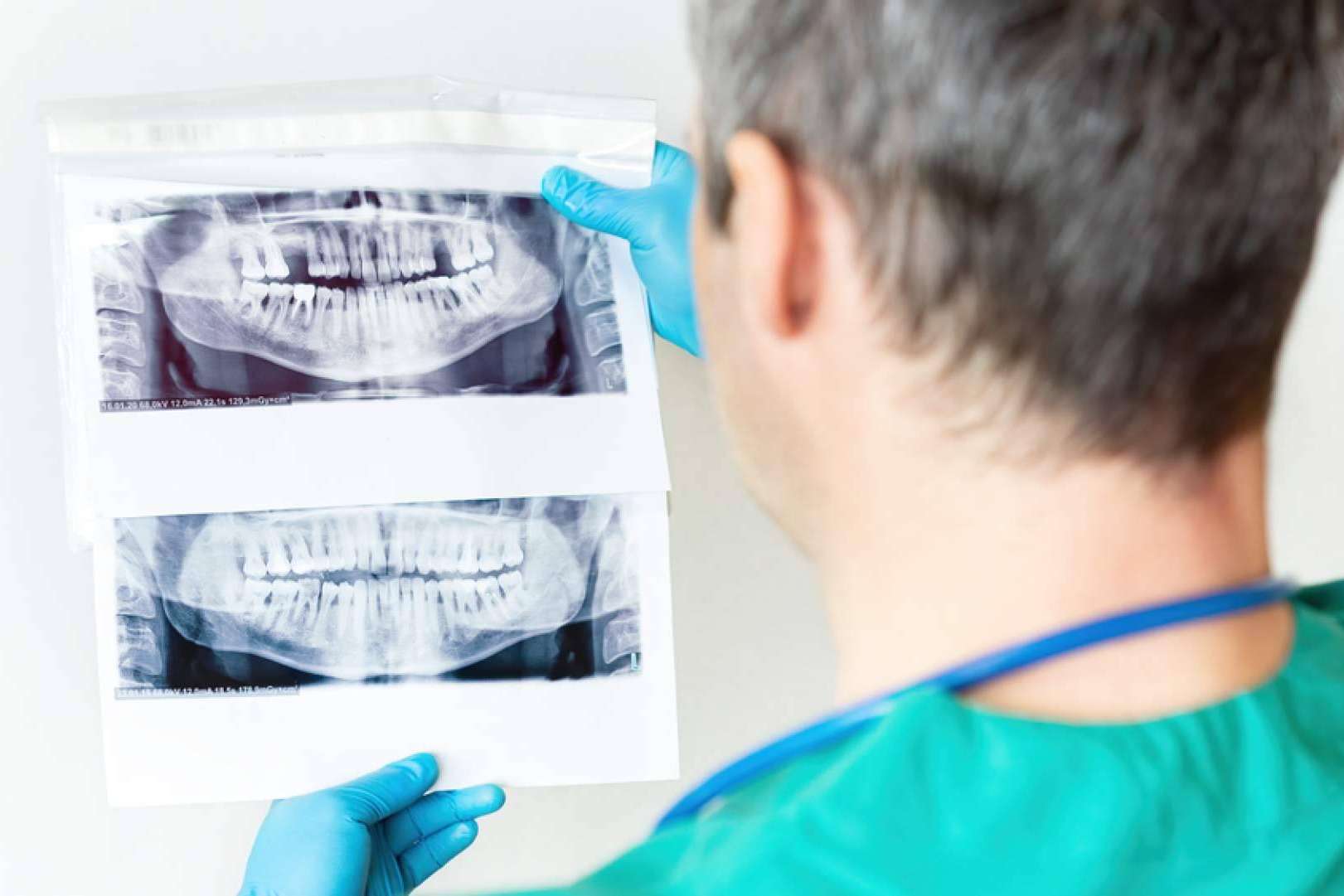 La clínica dental de Chamartín DeltaDent brinda una sonrisa perfecta