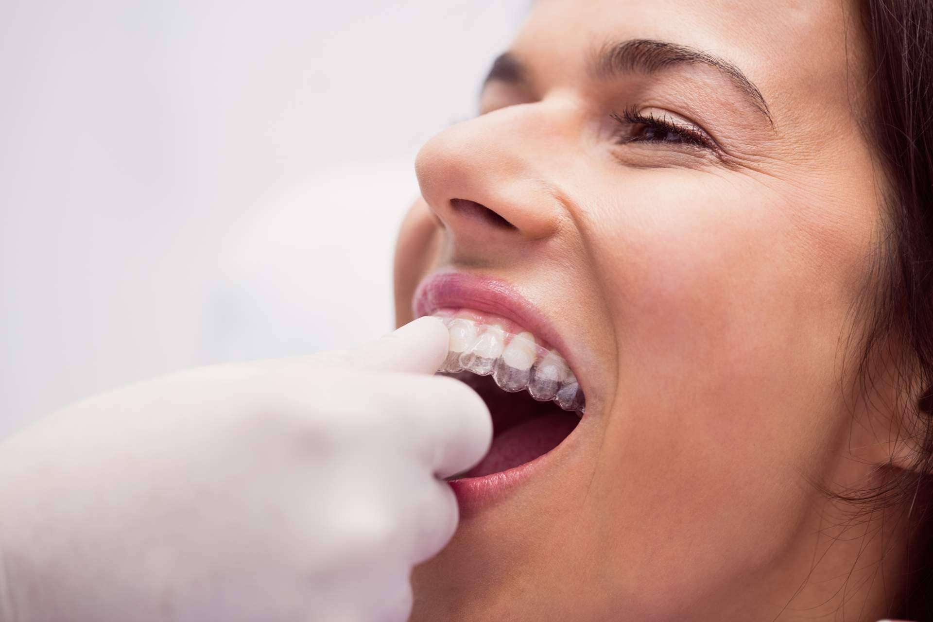 Clínica Dental Delgado expone toda la información importante sobre la ortodoncia para adultos