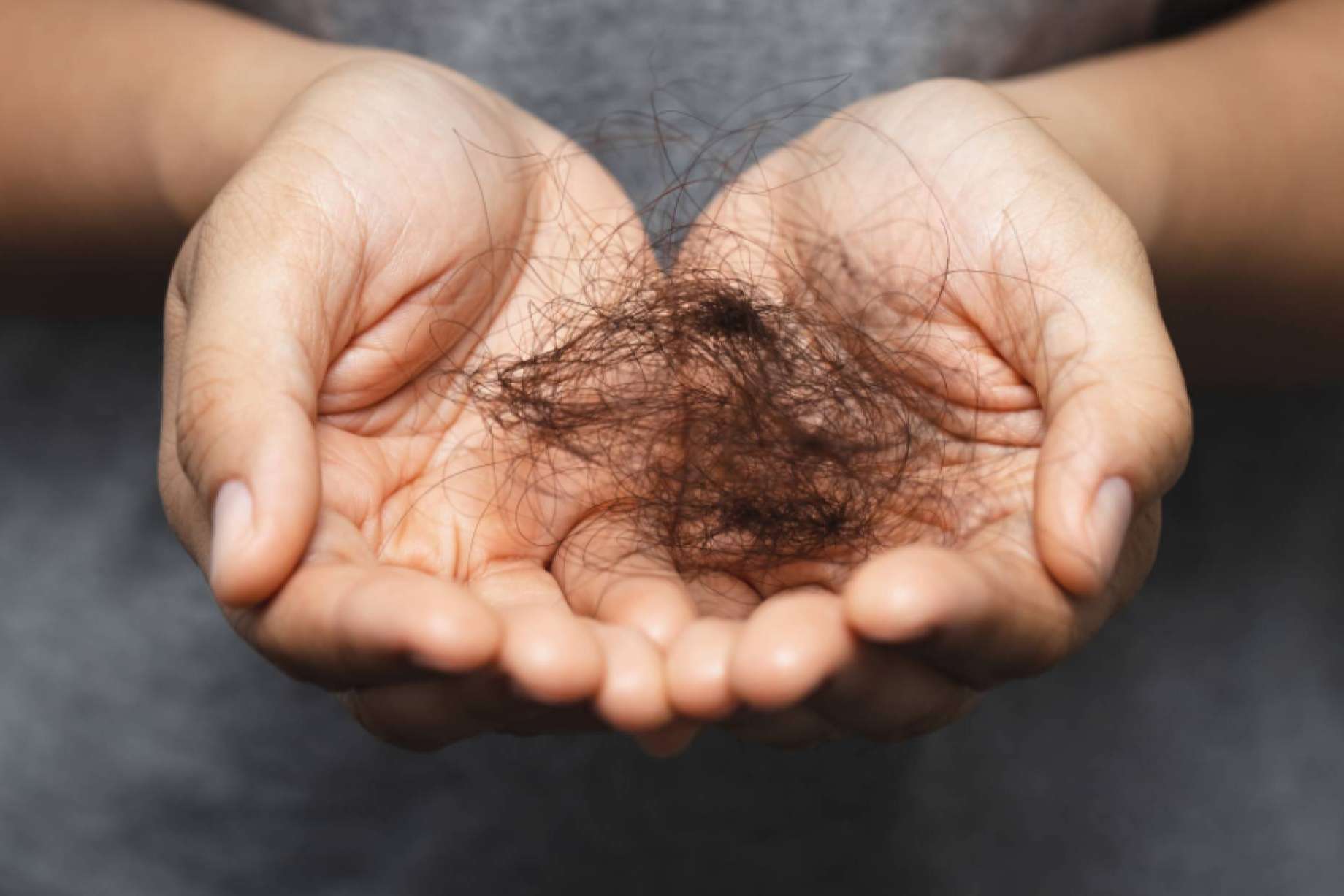 ¿Qué es y por qué se produce la alopecia femenina?, por Kmax