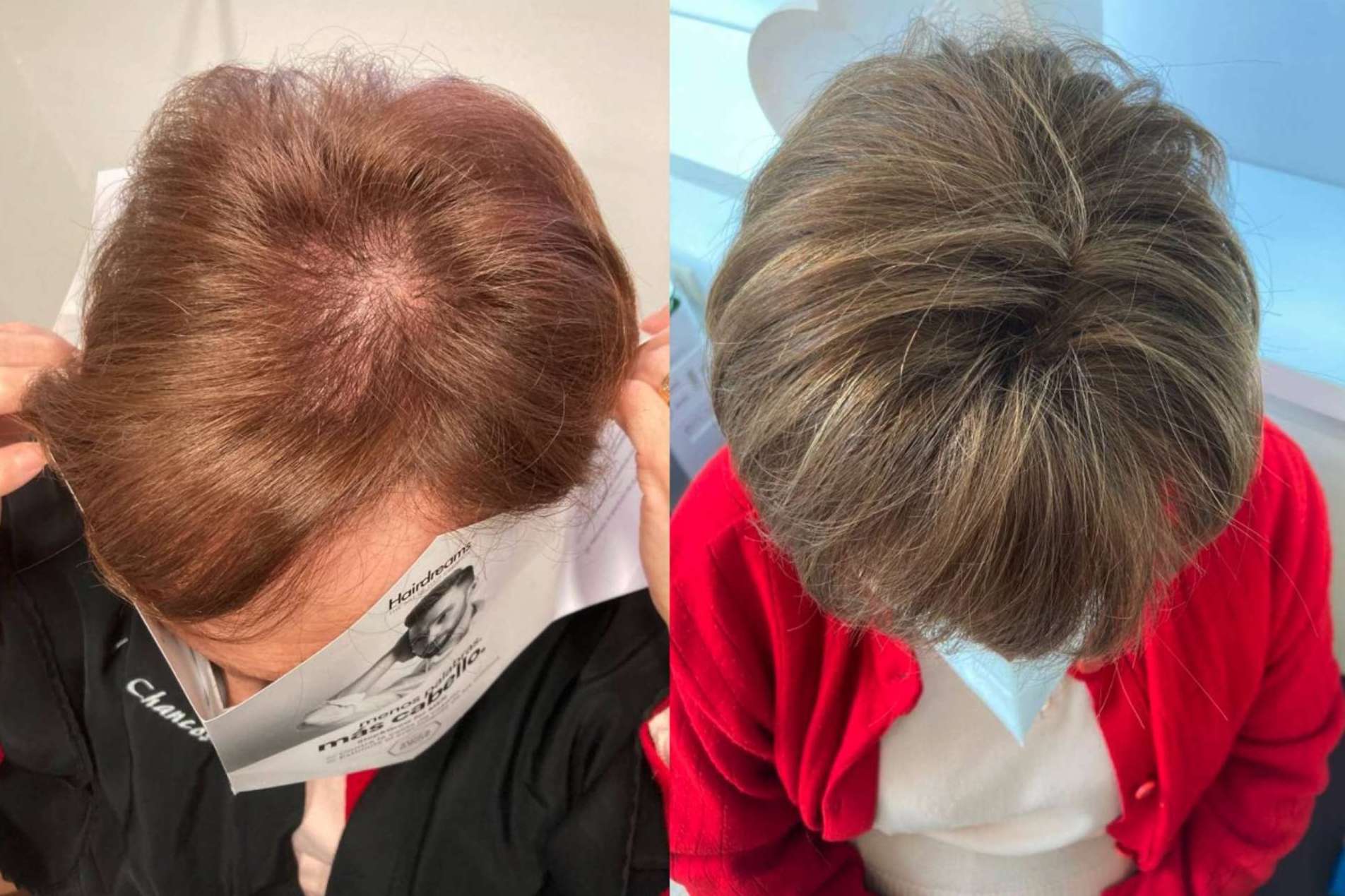 Mar Chancosa pone a disposición las extensiones de cabello 100% de cabello natural de Hairdreams