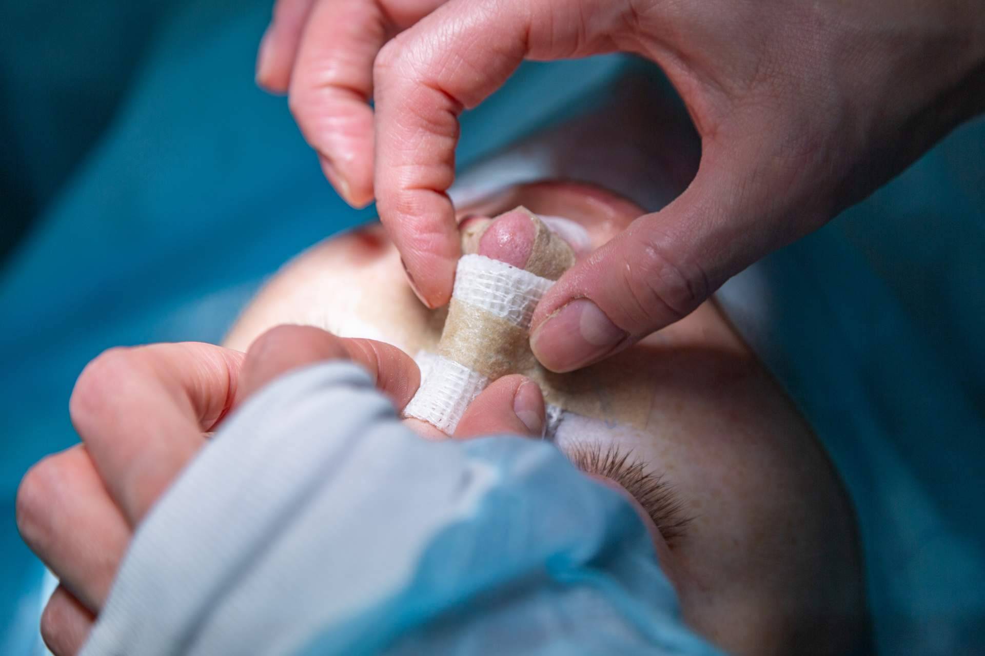 Clínica Calvo de Mora y todo lo que se debe saber sobre la rinoplastia