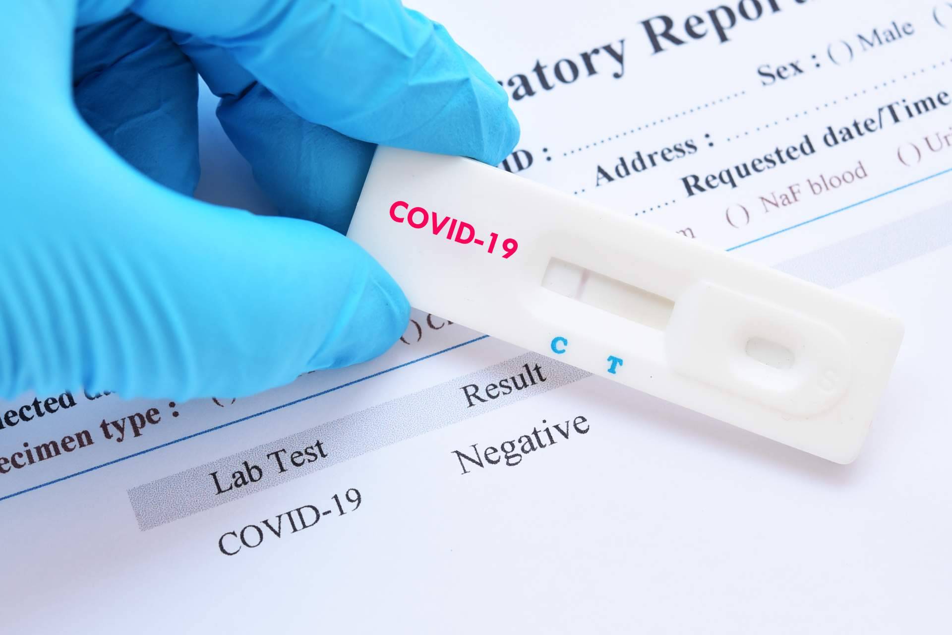 La importancia del test covid en las fiestas navideñas, de la mano de Centro Médico Bravo