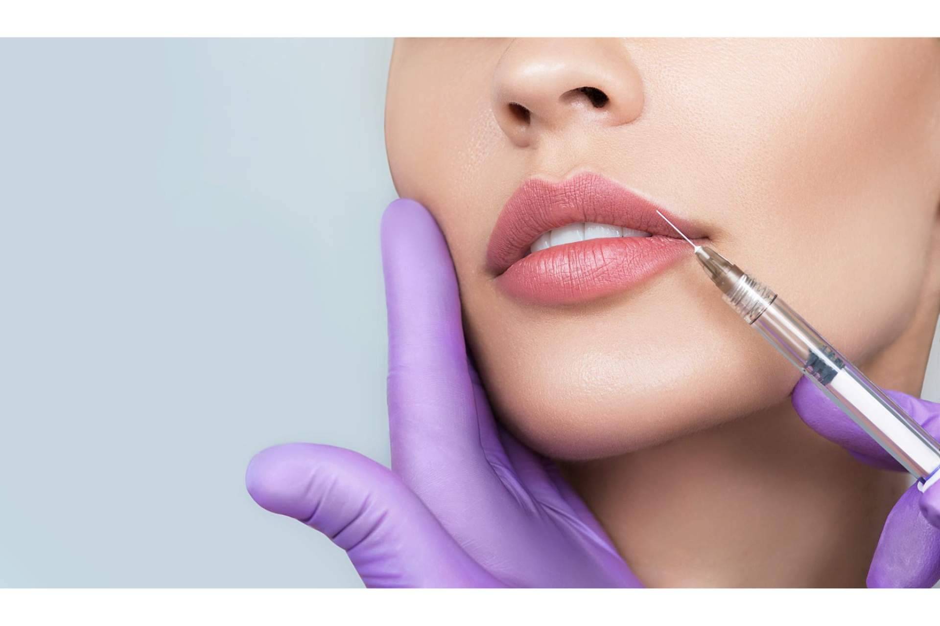 ¿En qué consiste la técnica innovadora Extreme lips de 360Clinics para un aumento de labios?