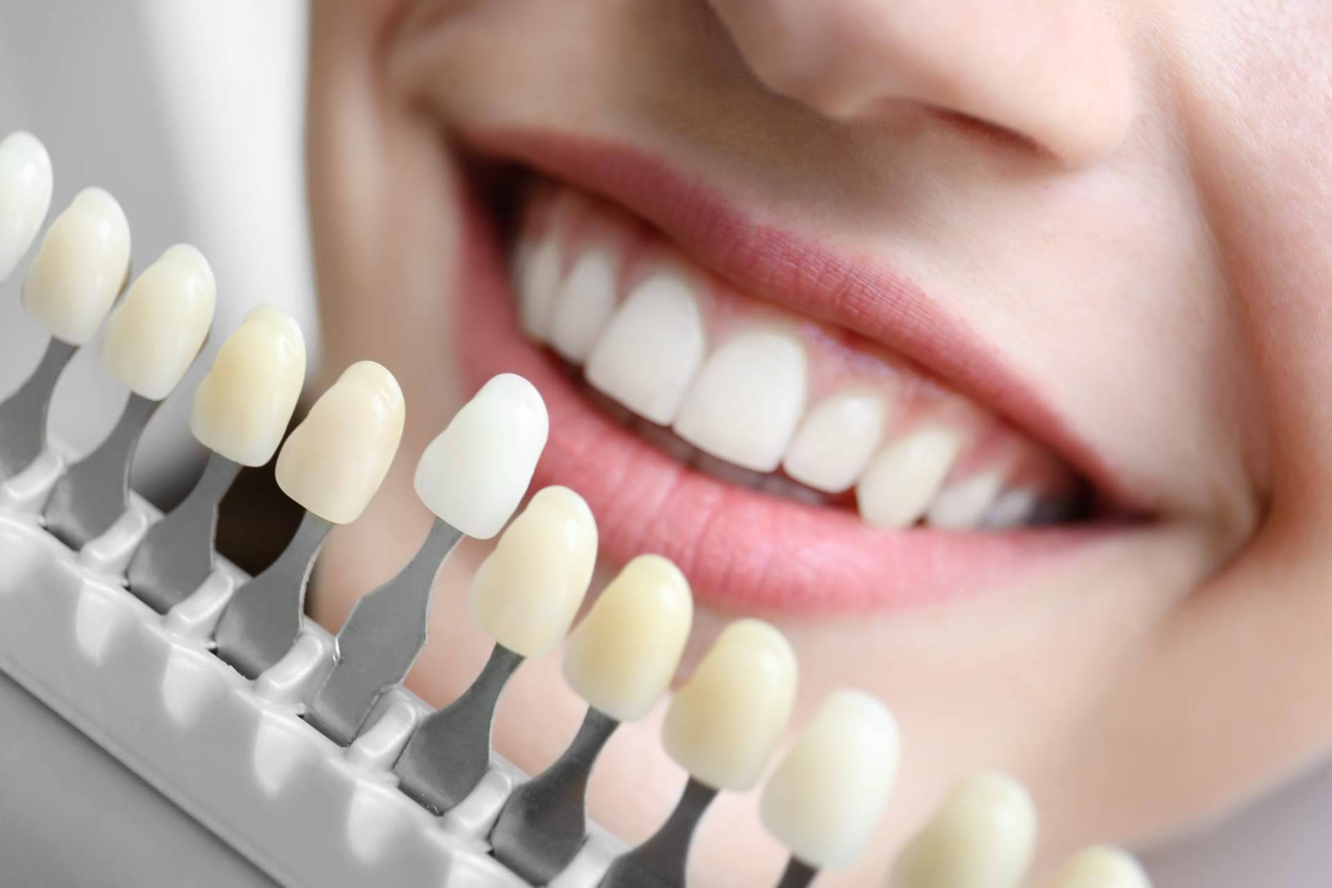 DrMouth ofrece implantes y tratamiento de ortodoncia