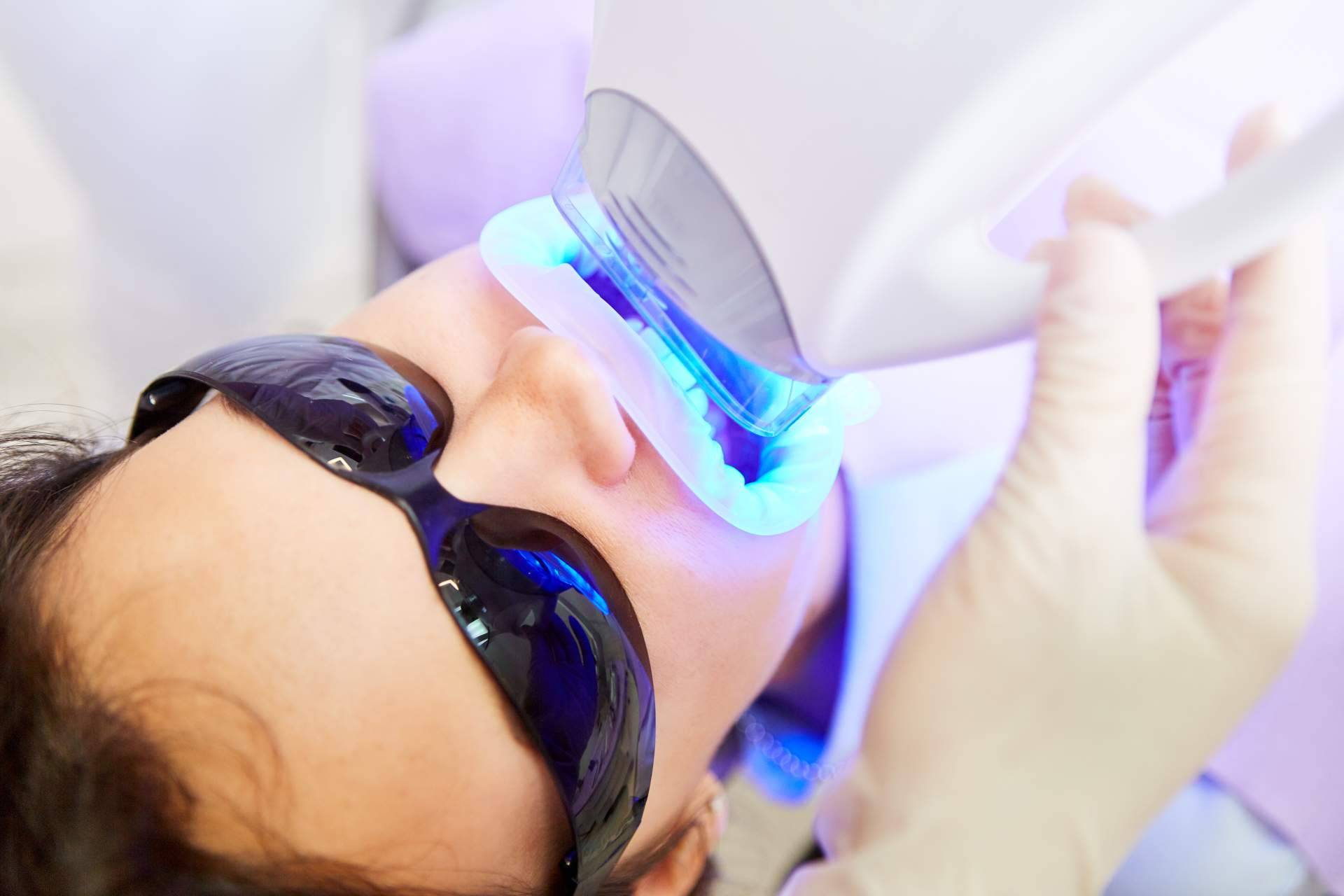 Cuidado de los dientes después de un blanqueamiento dental