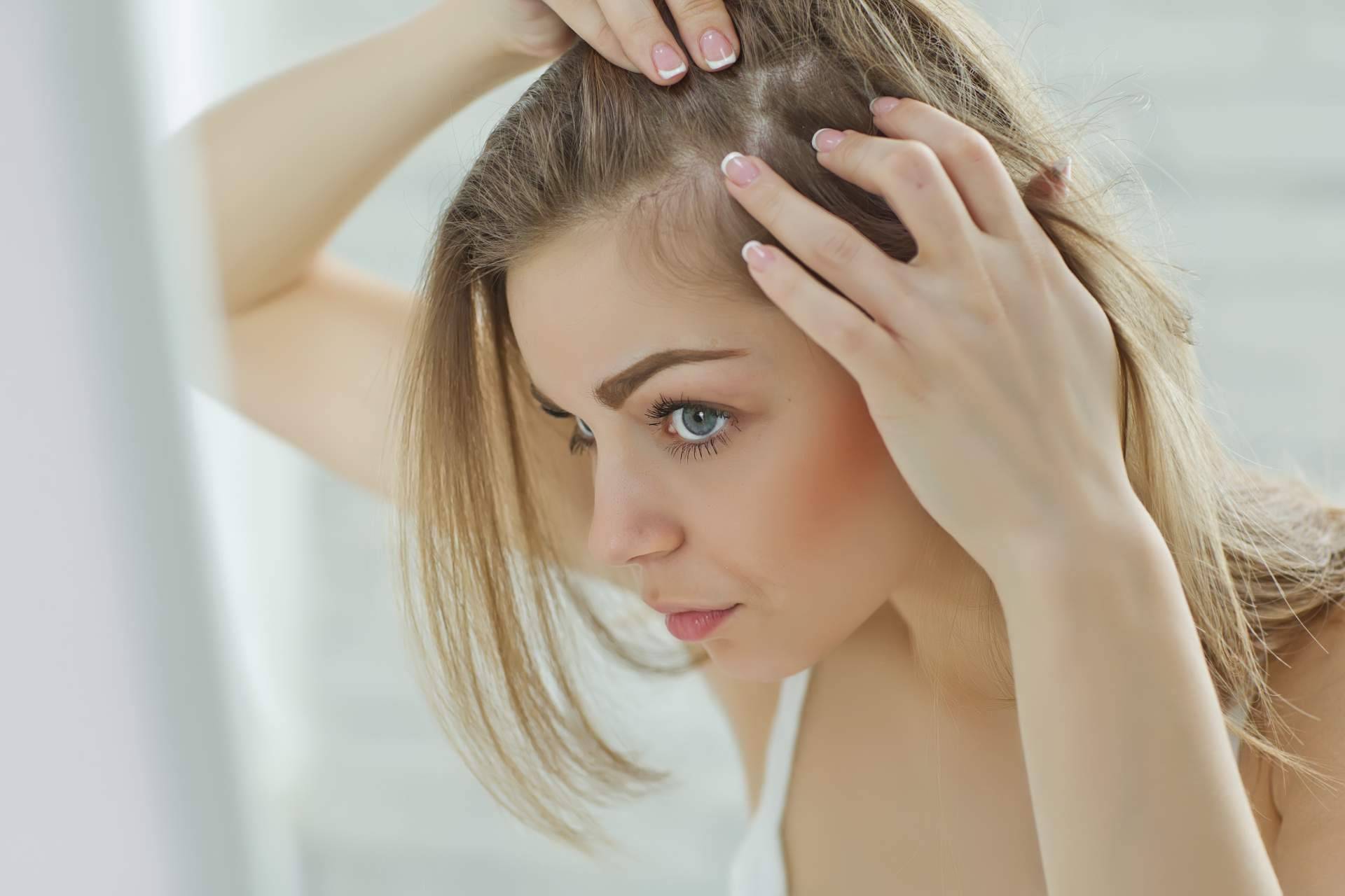Élite Capilar explica qué es el efluvio telógeno y cuáles son sus causas