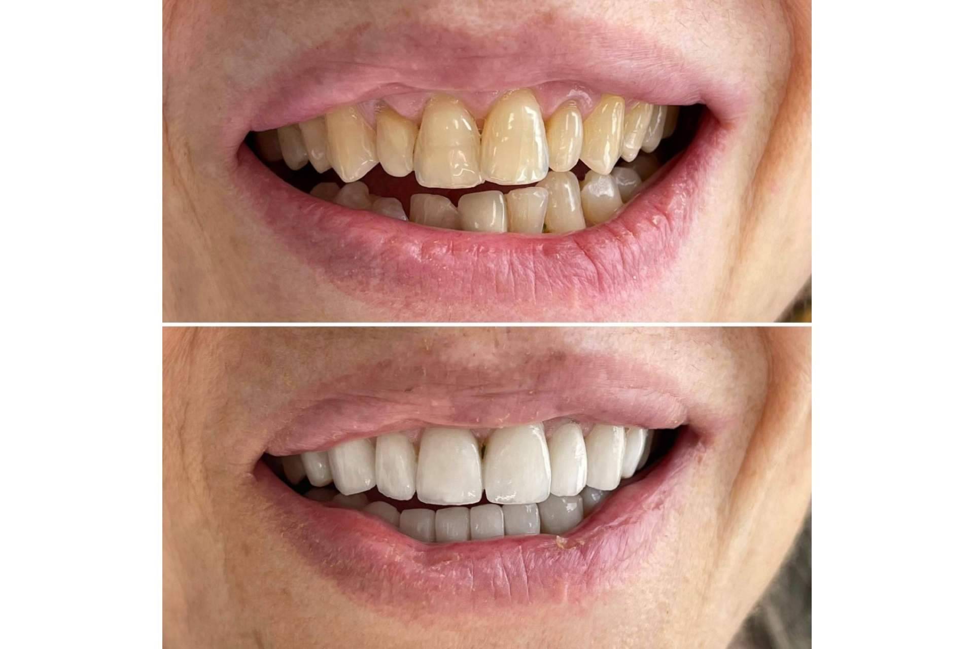 Clínica MG Dental, especialistas en estética dental