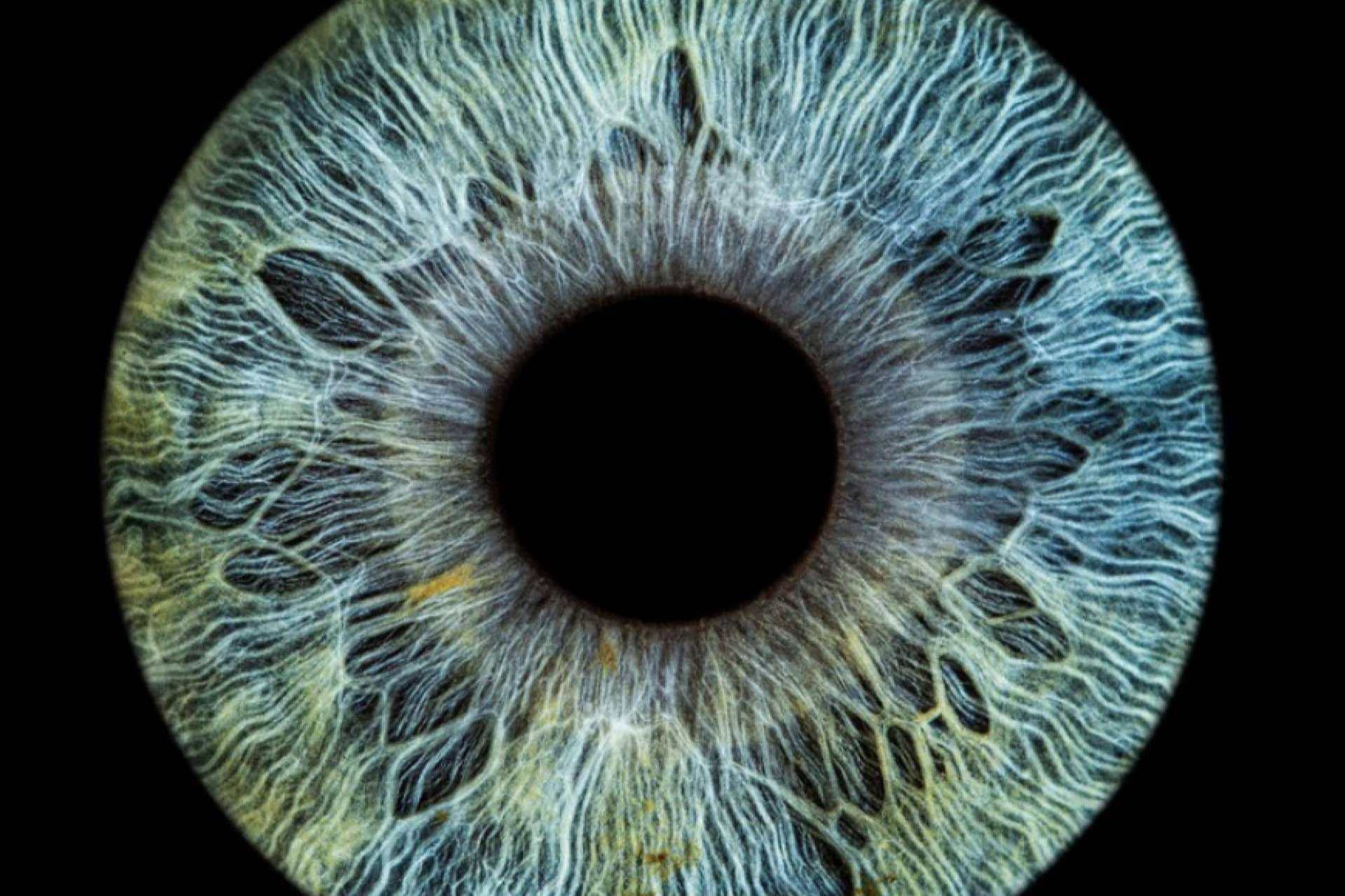 Nueva técnica fotográfica de alta definición del iris, con Eyecos