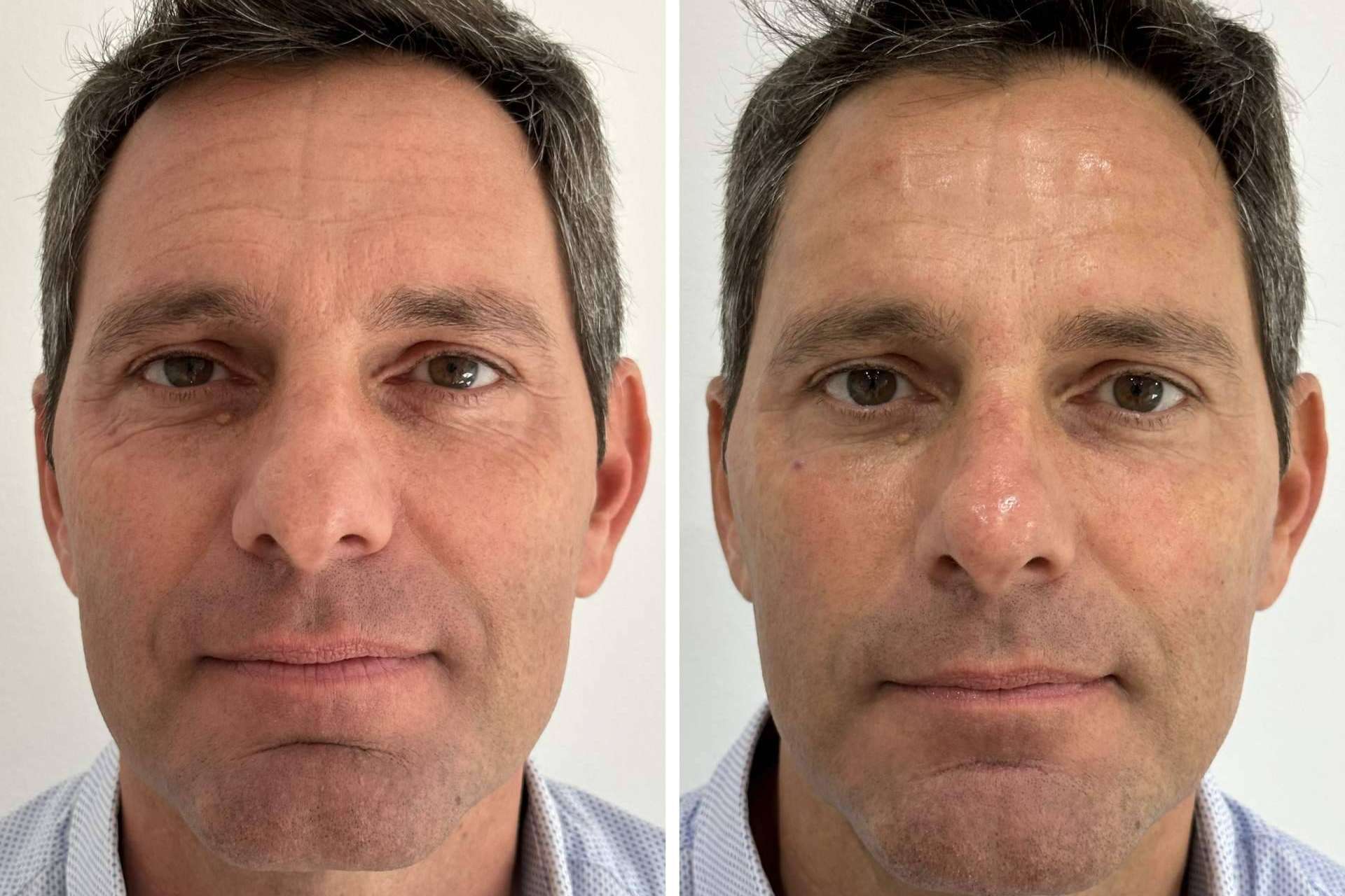 Clínica VISO permite mejorar la apariencia a través de sus tratamientos faciales