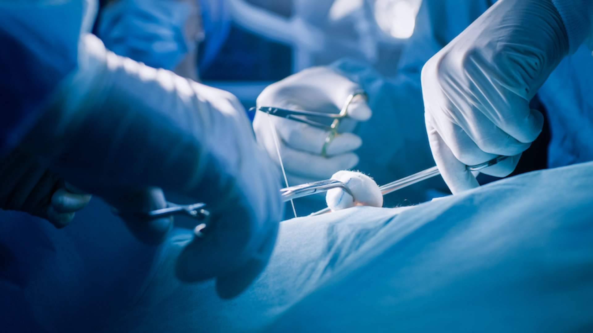 Innova Cirugía, clínica referente en el uso de tecnología avanzada para el tratamiento del sinus pilonidal